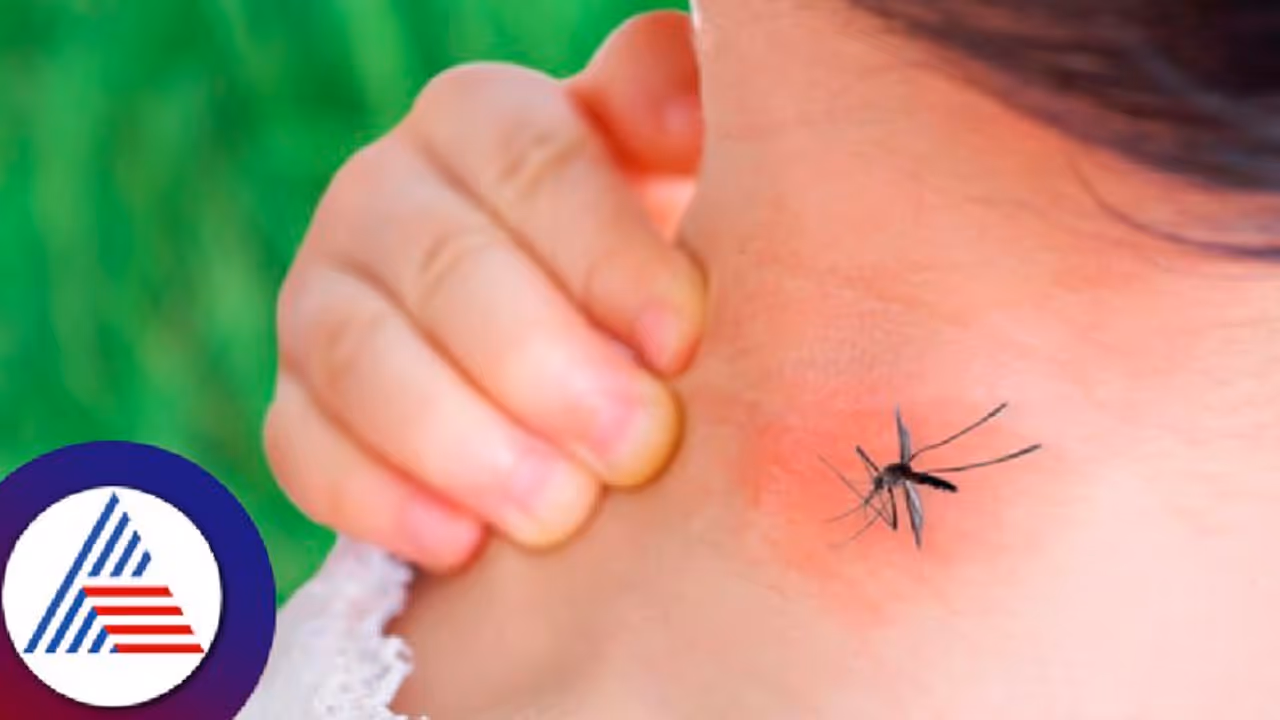  தீவிரமாய் பரவும் டெங்கு காய்ச்சல் : தடுக்க சிம்பிள் வழிகள் இதோ..!!