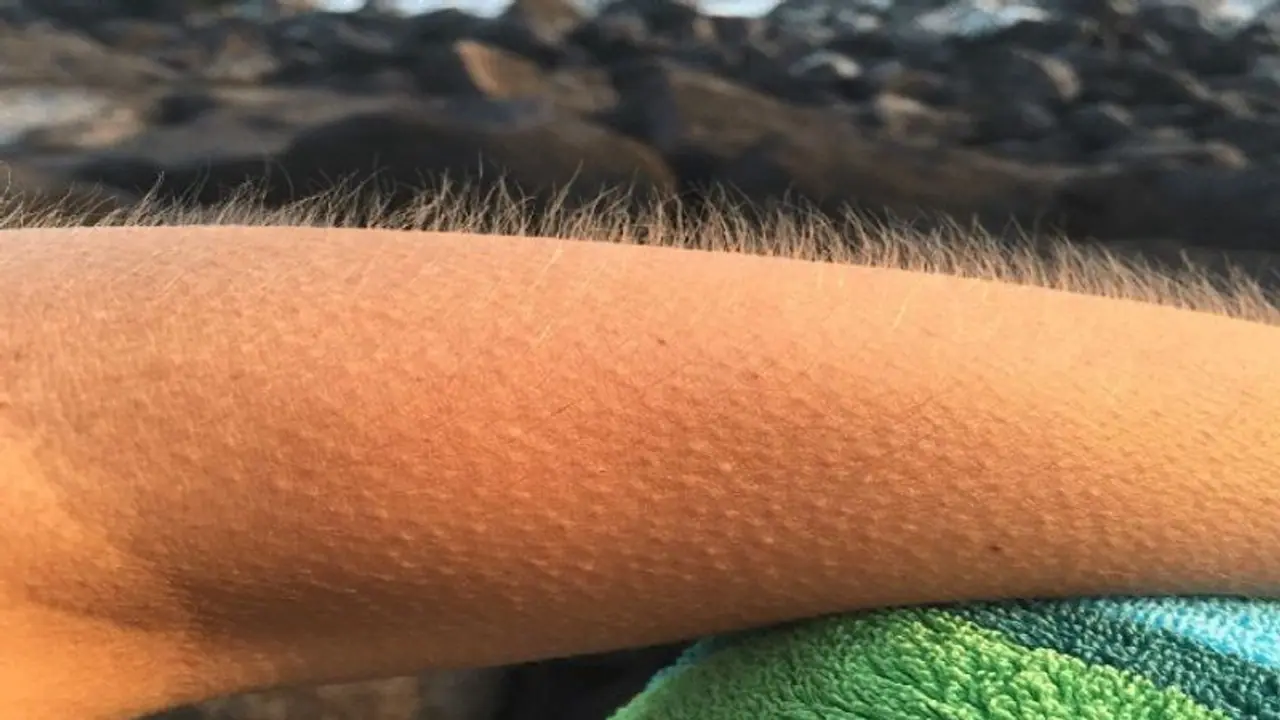 உடலில் புல்லரிப்பு ஏற்படுவதற்கான காரணம் என்ன தெரியுமா? 