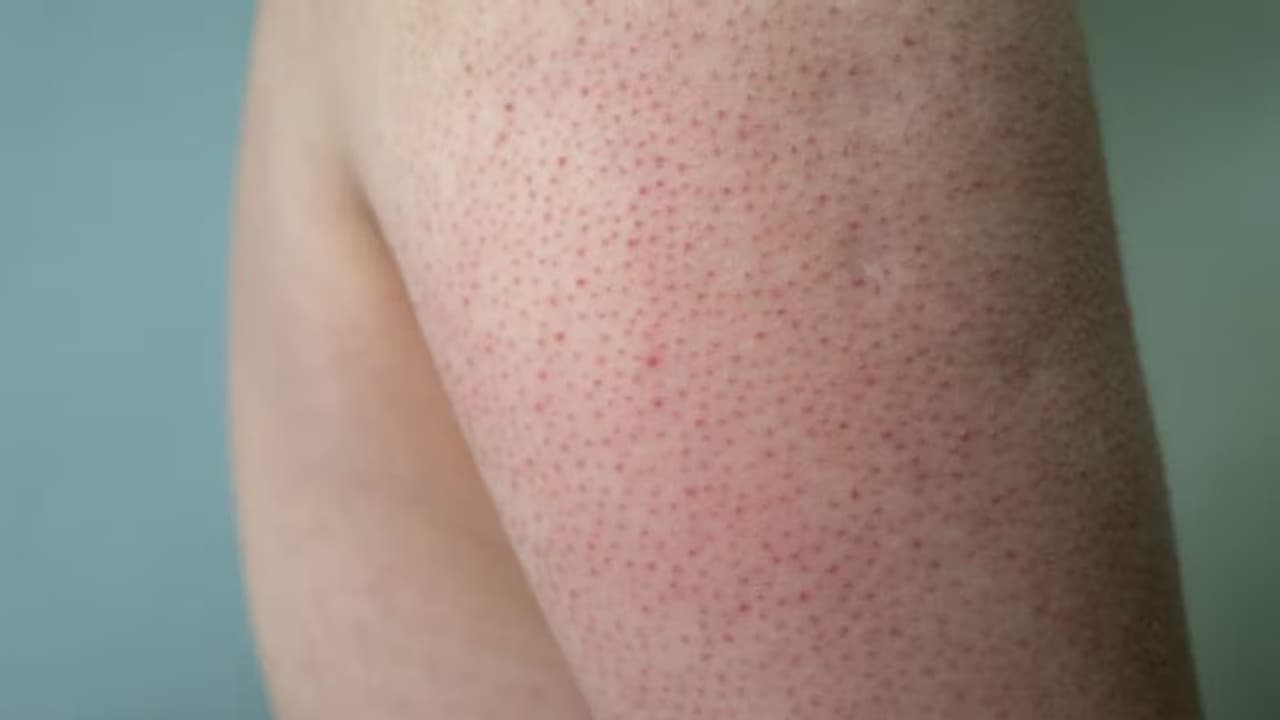 വിറ്റാമിന് സിയുടെ കുറവ്; ചര്മ്മത്തില് കാണുന്ന ഈ ലക്ഷണങ്ങള് സൂചനയാകാം... വിറ്റാമിന് സിയുടെ കുറവ്; ചര്മ്മത്തില് കാണുന്ന ഈ ലക്ഷണങ്ങള് സൂചനയാകാം...