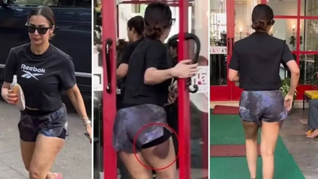 Watch: Malaika Arora spotted with dark black bruise on her thighs; leaving fans worried Watch: Malaika Arora spotted with dark black bruise on her thighs; leaving fans worried