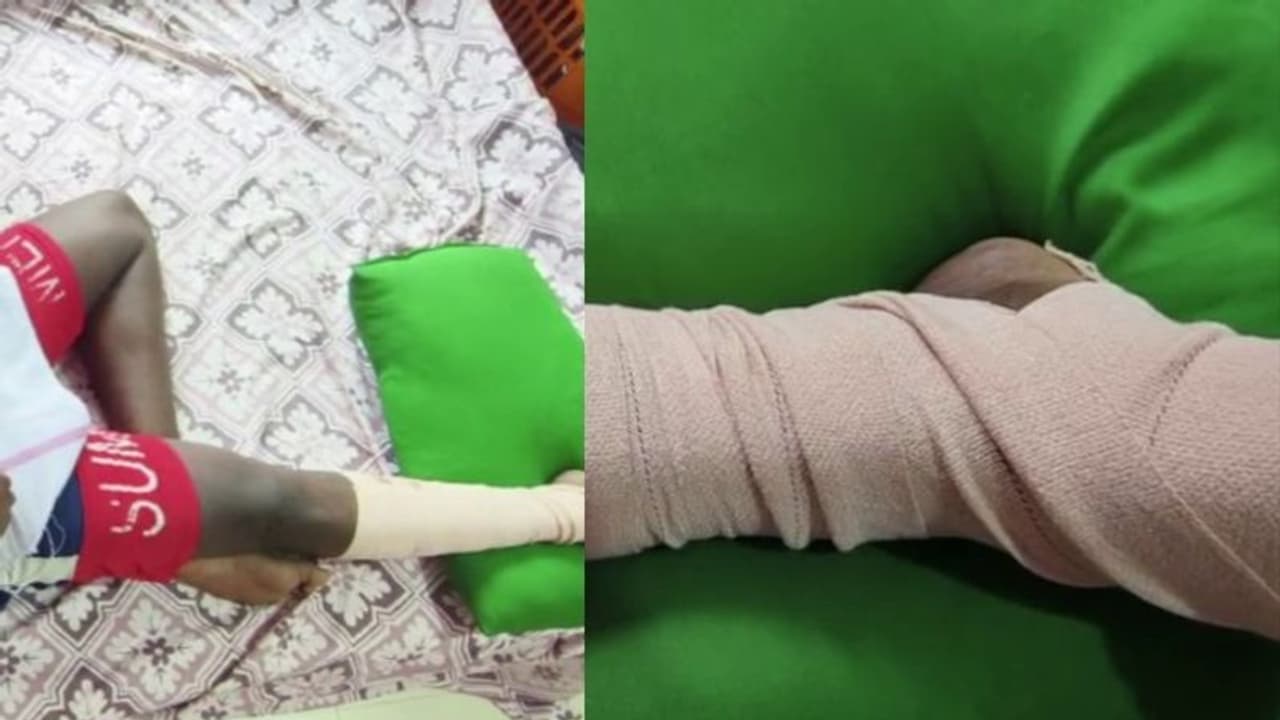 സീനിയർ വിദ്യാര്‍ത്ഥികൾ കൂട്ടം ചേർന്ന് ആക്രമിച്ചതായി പരാതി, ഒന്നാം വർഷ ബിരുദ വിദ്യാർത്ഥിക്ക് ഗുരുതര പരിക്ക്