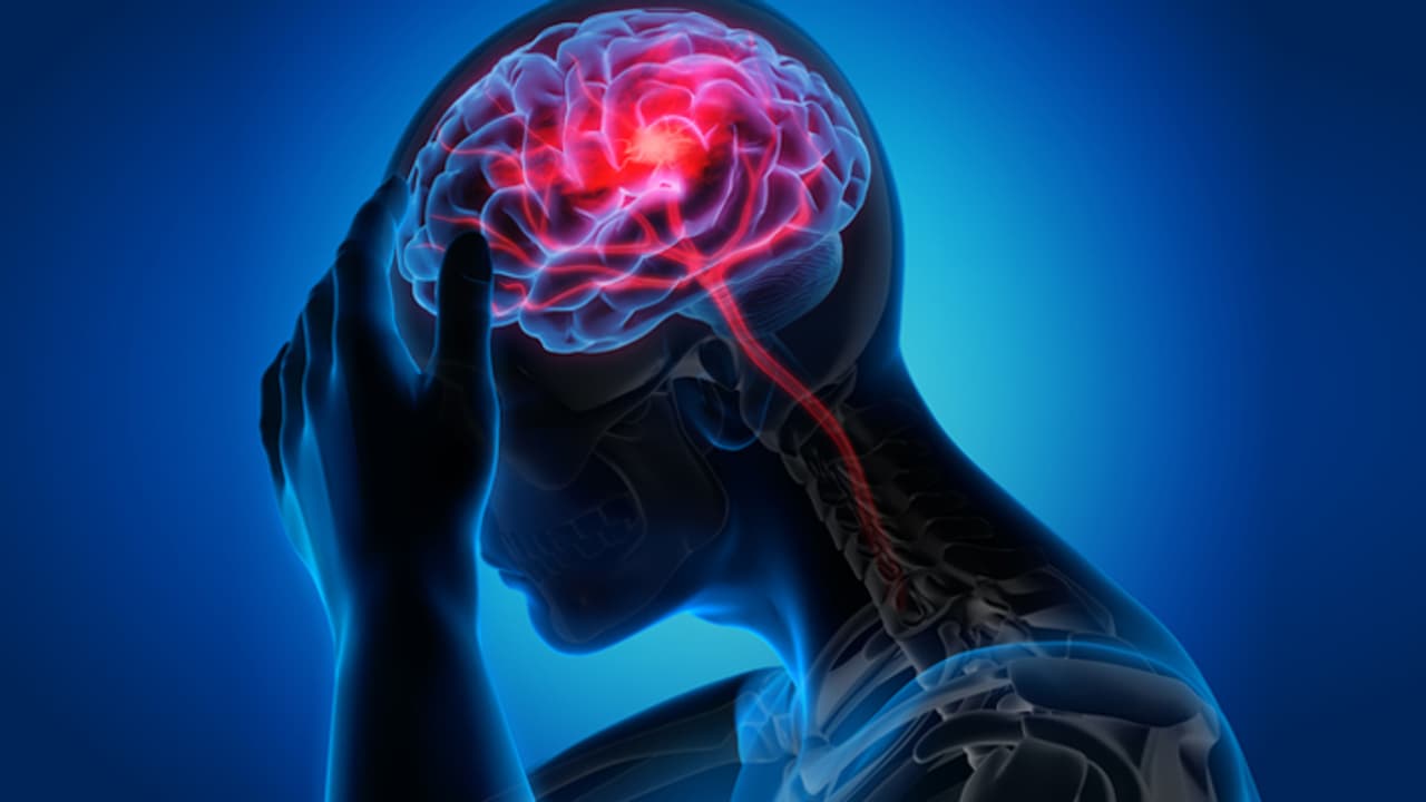 World Stroke Day 2023 World Stroke Day 2023