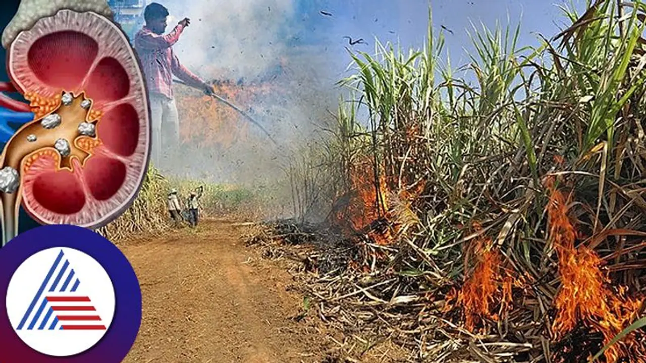 Kidney Stones: ಕಿಡ್ನಿ ಕಲ್ಲಿನ ಸಮಸ್ಯೆಯೇ? ಯೋಗದಲ್ಲಿದೆ ಪರಿಹಾರ