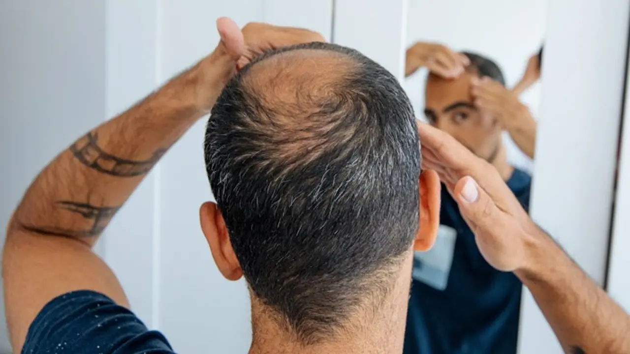 Homeopathy remedies to stop hair fall and regrow hair, you can take 7 days challenge bsm Homeopathy remedies to stop hair fall and regrow hair, you can take 7 days challenge bsm