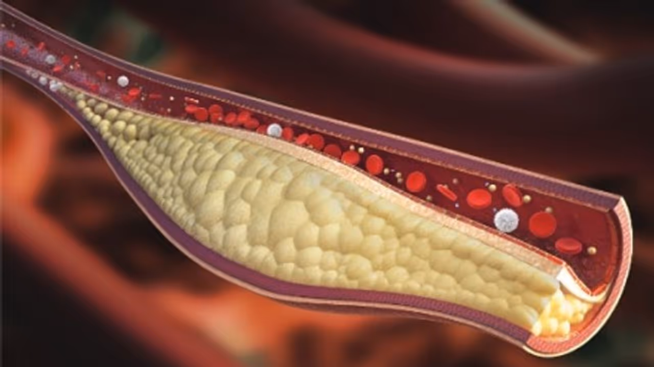കൊളസ്ട്രോൾ കുറയ്ക്കണോ? എങ്കിൽ ഈ ഭക്ഷണം ഡയറ്റിൽ ഉൾപ്പെടുത്തി കൊള്ളൂ