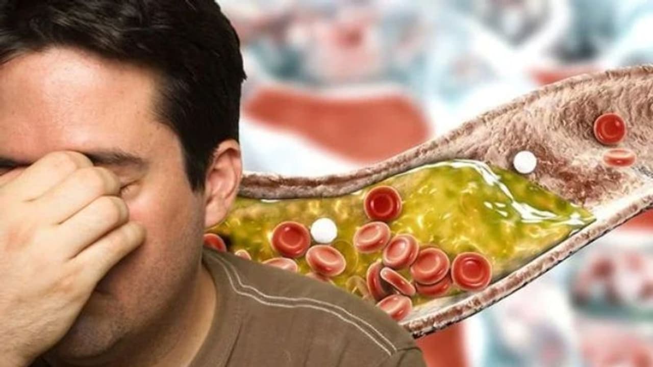 cholesterol cholesterol