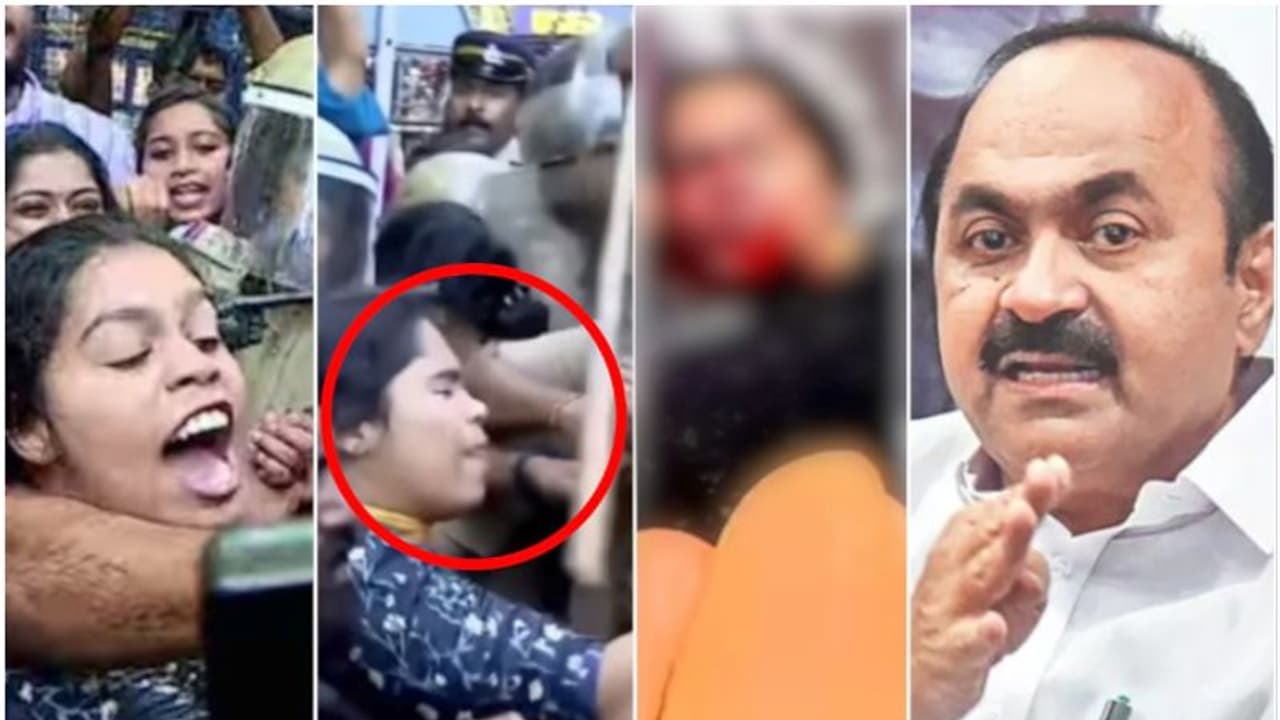 ക്രൂരം, മുക്കിനിടിയേറ്റ പെൺകുട്ടിക്ക് സർജറി വേണം; 'ഇവനൊക്കെ മക്കളില്ലേ', നടപടി വേണമെന്നും പ്രതിപക്ഷ നേതാവ് ക്രൂരം, മുക്കിനിടിയേറ്റ പെൺകുട്ടിക്ക് സർജറി വേണം; 'ഇവനൊക്കെ മക്കളില്ലേ', നടപടി വേണമെന്നും പ്രതിപക്ഷ നേതാവ്