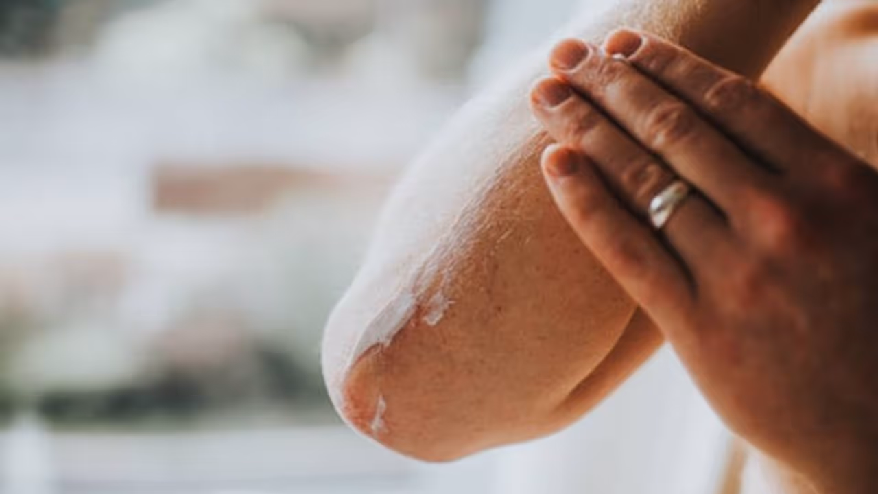 സ്കിൻ വരണ്ടുണങ്ങുന്നുവോ? ഇത് മാറ്റാൻ കഴിക്കാം ഈ ഭക്ഷണങ്ങള്‍...