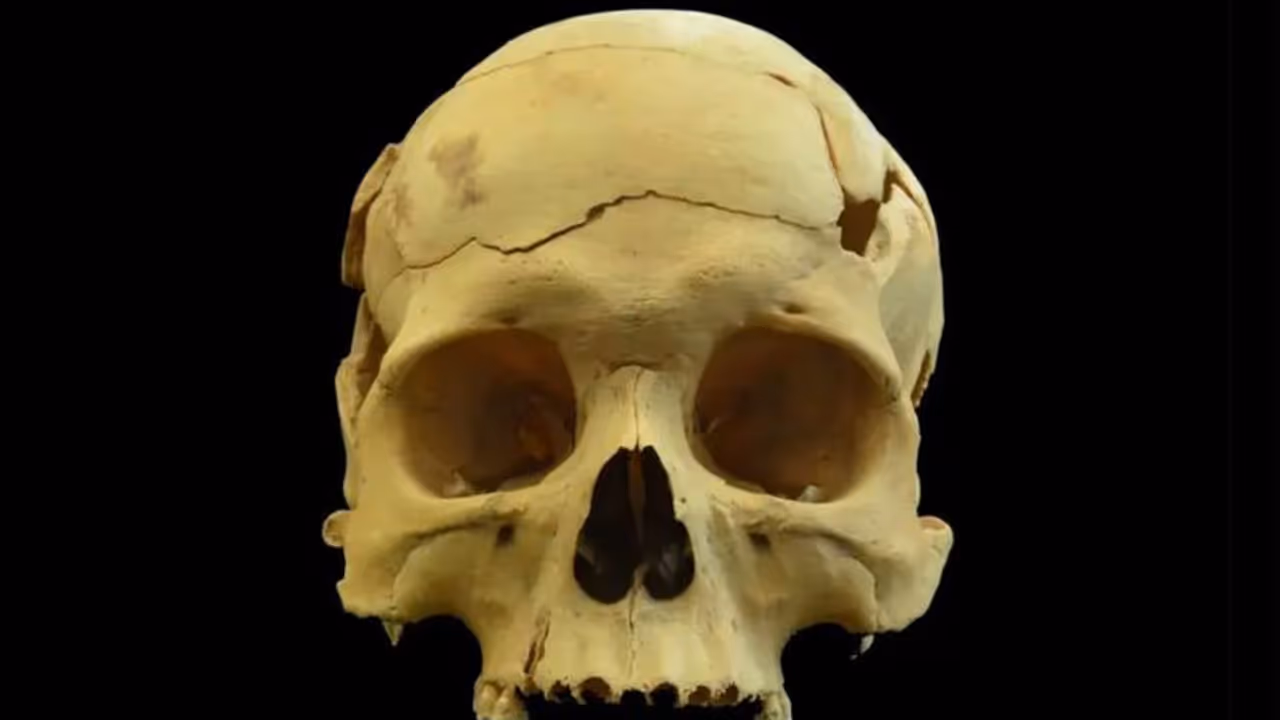 Fascinating! Skull found in China reveals advanced brain surgery performed 2,700 years ago Fascinating! Skull found in China reveals advanced brain surgery performed 2,700 years ago