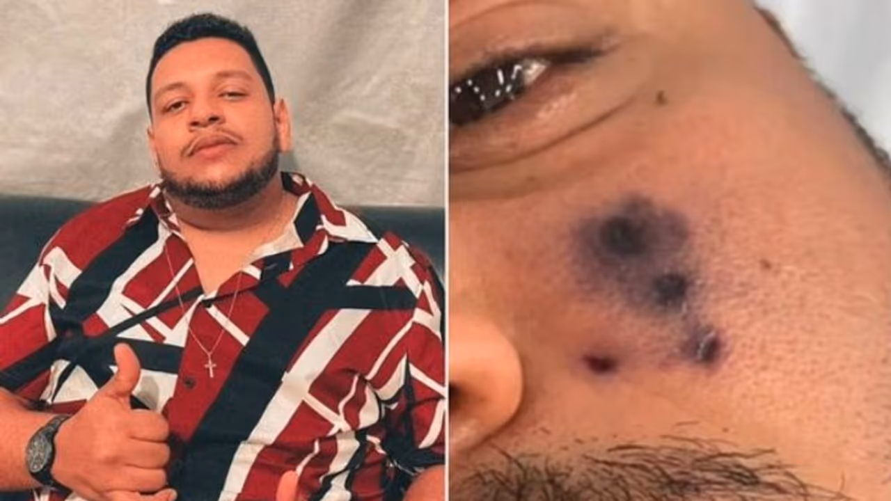 മുഖത്ത് എട്ടുകാലിയുടെ കടിയേറ്റു; ദിവസങ്ങള്‍ക്കകം ഗായകന് ദാരുണാന്ത്യം