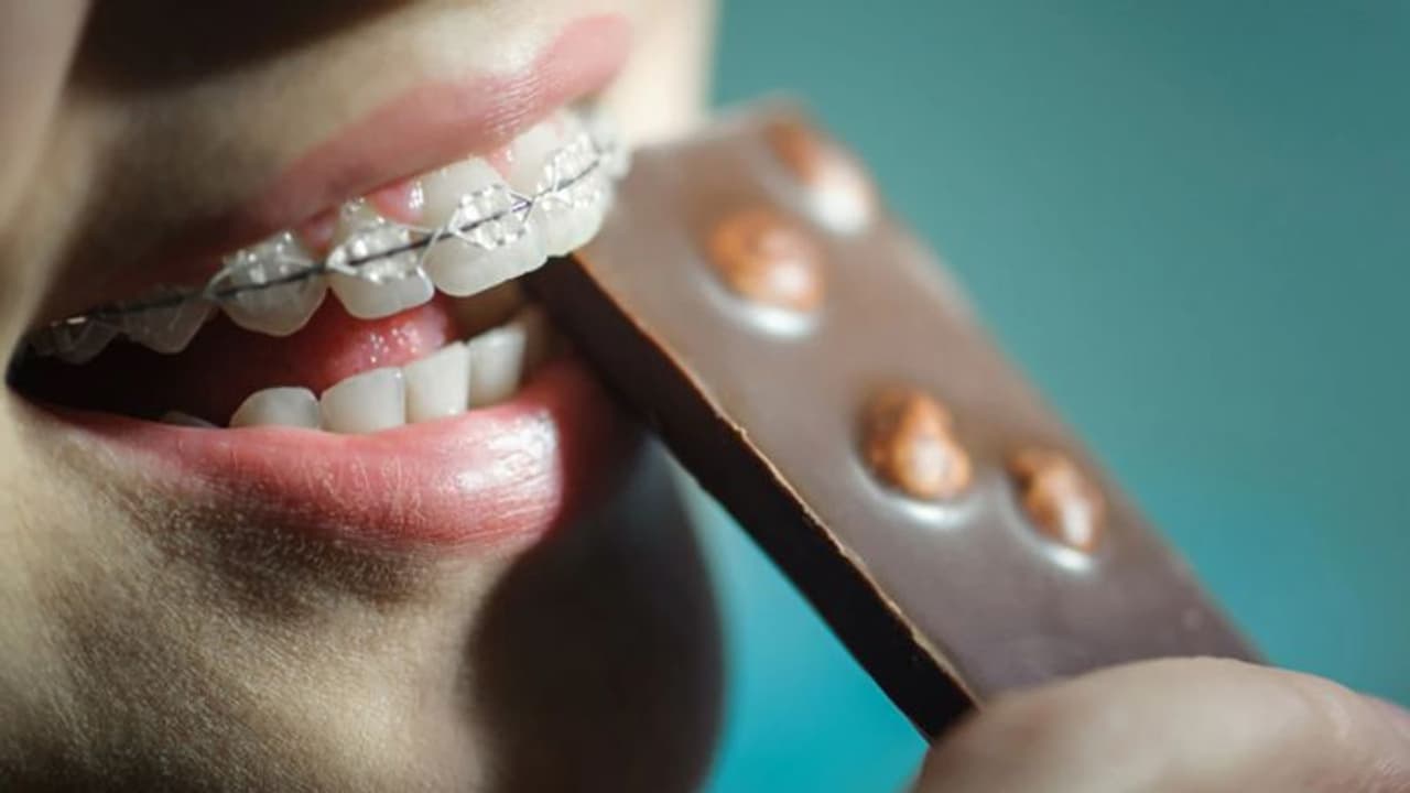 പല്ലില്‍ കമ്പിയുണ്ടോ? എങ്കില്‍, ഈ അഞ്ച് ഭക്ഷണങ്ങള്‍ കഴിക്കരുതേ...