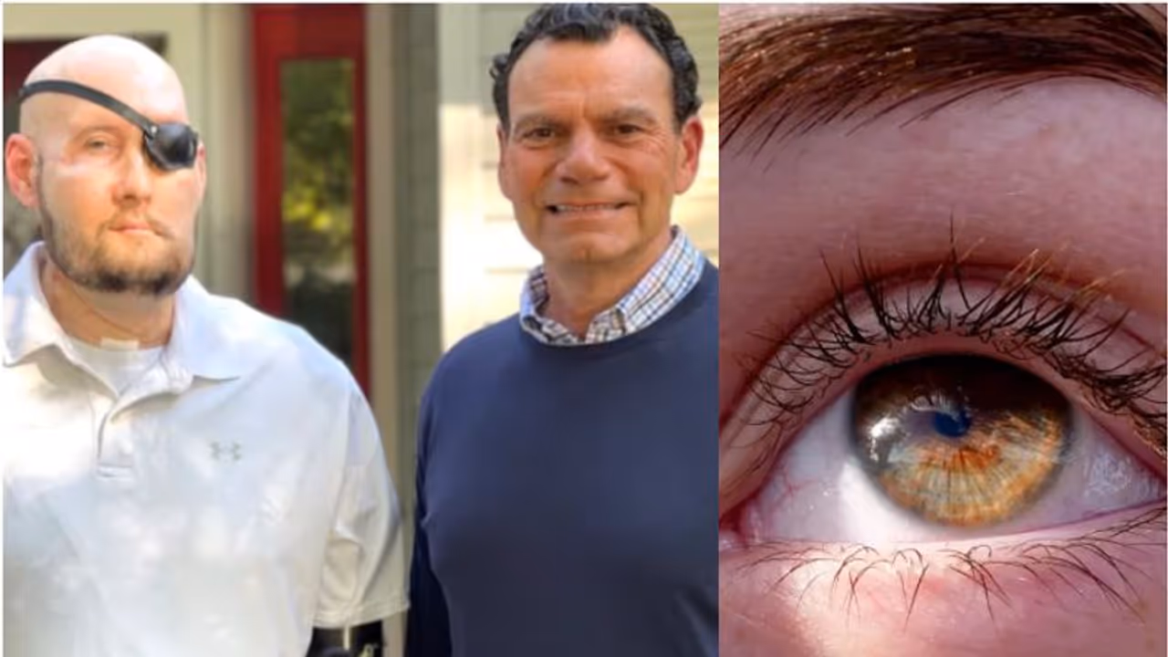 അങ്ങനെ അതും സാധ്യം; കണ്ണ് പൂർണമായി മാറ്റിവെക്കല്‍ ശസ്ത്രക്രിയ പൂര്‍ത്തിയാക്കി, മെഡിക്കൽ സയൻസിന് അപൂർവ നേട്ടം