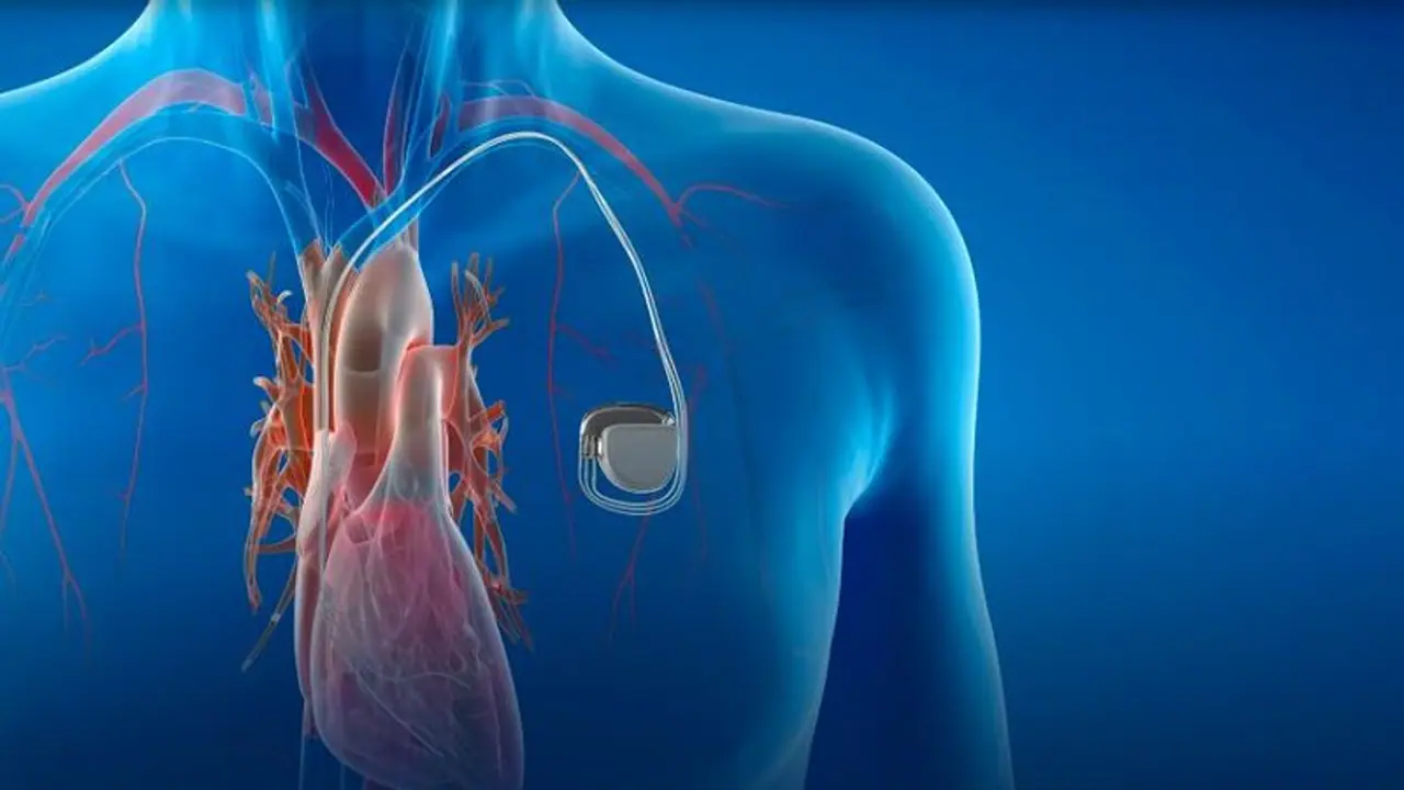 ಹೃದ್ರೋಗಿಗಳಿಗೆ ಕಳಪೆ ಪೇಸ್‌ಮೇಕರ್‌ ಅಳವಡಿಕೆ : 200 ರೋಗಿಗಳ ಸಾವು ಶಂಕೆ: ವೈದ್ಯನ ಬಂಧನ
