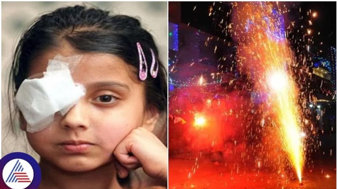 ದೀಪಾವಳಿಗೆ 24x7 ಕಣ್ಣಿನ ಚಿಕಿತ್ಸೆ, ಸಹಾಯವಾಣಿ ಆರಂಭಿಸಿದ ಮಿಂಟೋ ಆಸ್ಪತ್ರೆ: ಈಗ್ಲೇ ನೋಟ್ ಮಾಡ್ಕೊಳಿ! ದೀಪಾವಳಿಗೆ 24x7 ಕಣ್ಣಿನ ಚಿಕಿತ್ಸೆ, ಸಹಾಯವಾಣಿ ಆರಂಭಿಸಿದ ಮಿಂಟೋ ಆಸ್ಪತ್ರೆ: ಈಗ್ಲೇ ನೋಟ್ ಮಾಡ್ಕೊಳಿ!