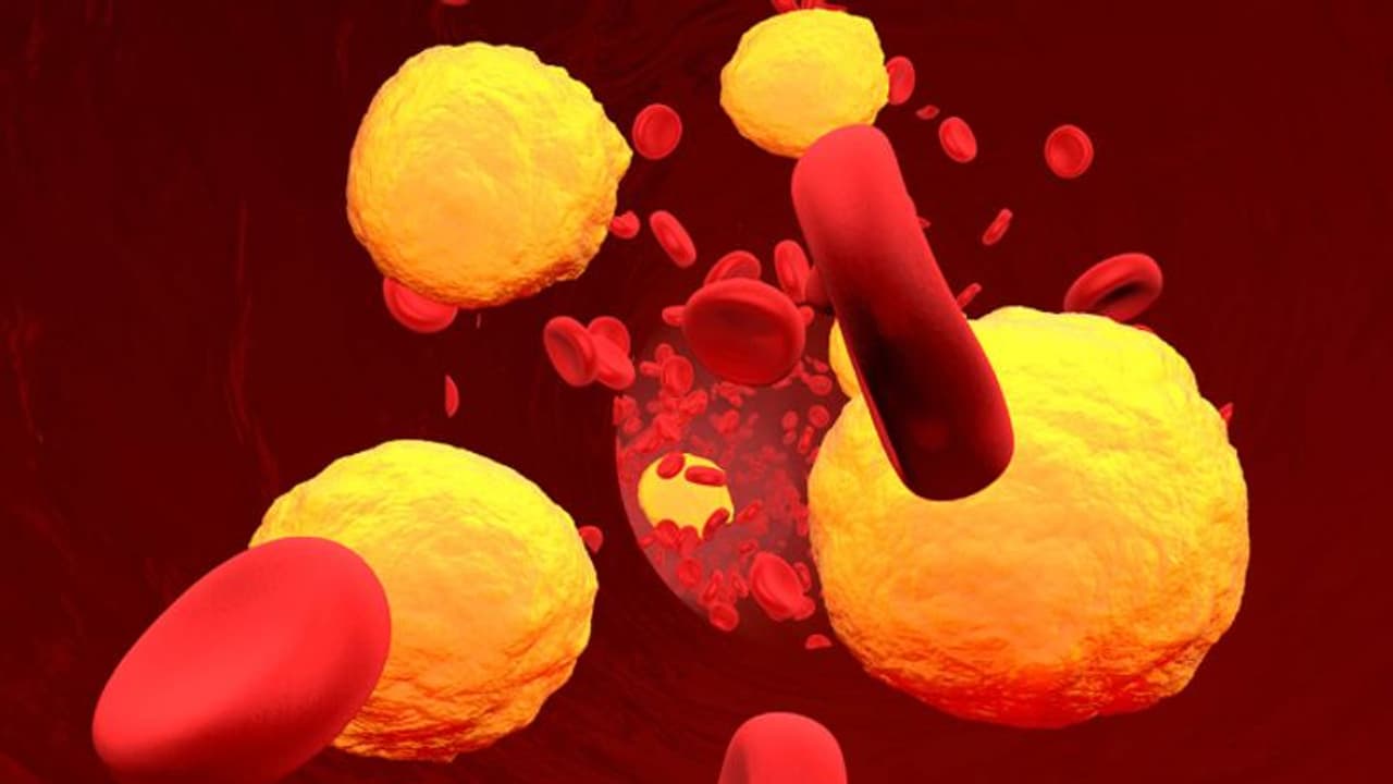 ഈ ആറ് ഭക്ഷണങ്ങള് മാത്രം കഴിച്ചാല് മതി, ചീത്ത കൊളസ്ട്രോള് കുറയ്ക്കാം... ഈ ആറ് ഭക്ഷണങ്ങള് മാത്രം കഴിച്ചാല് മതി, ചീത്ത കൊളസ്ട്രോള് കുറയ്ക്കാം...