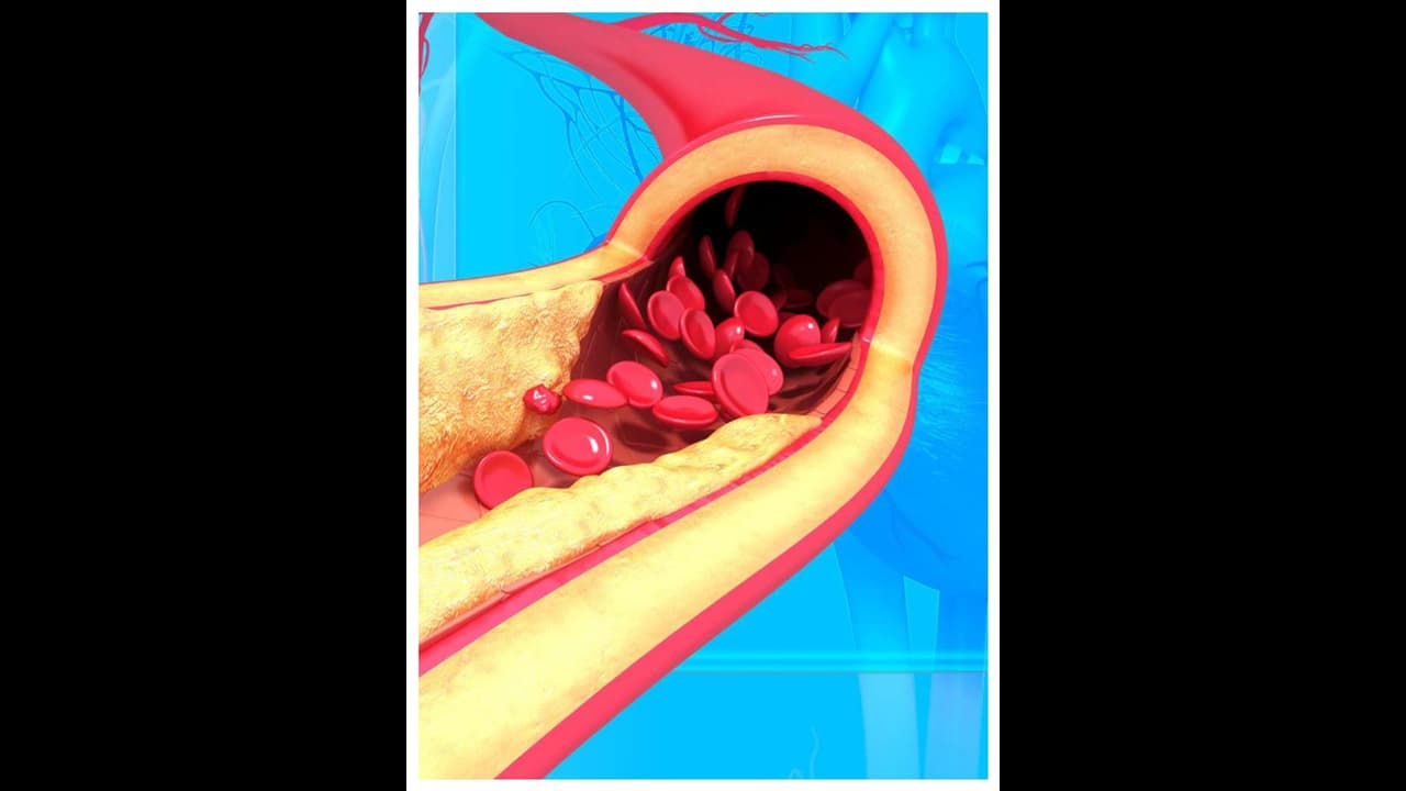 ചീത്ത കൊളസ്ട്രോൾ എളുപ്പം കുറയ്ക്കാം ; ഡയറ്റിൽ ഉൾപ്പെടുത്തൂ ഈ നട്സുകൾ ചീത്ത കൊളസ്ട്രോൾ എളുപ്പം കുറയ്ക്കാം ; ഡയറ്റിൽ ഉൾപ്പെടുത്തൂ ഈ നട്സുകൾ