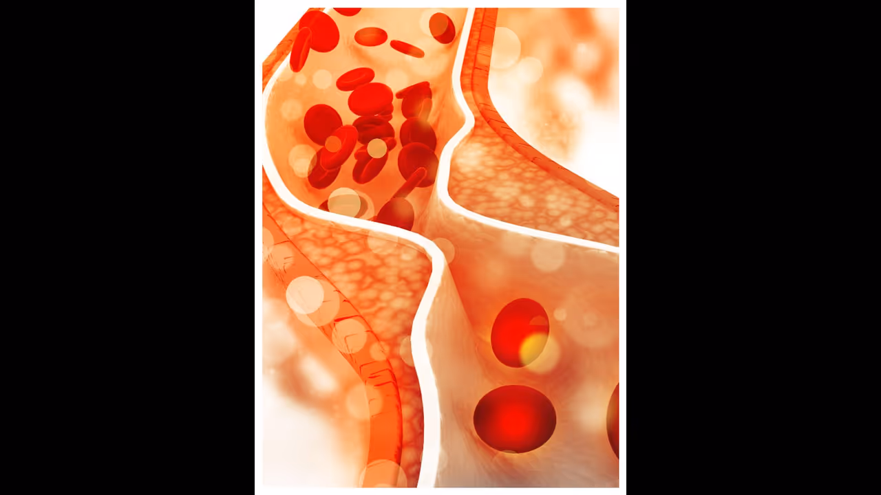 മോശം കൊളസ്ട്രോൾ കുറയ്ക്കണോ ? ഇക്കാര്യങ്ങള്‍ മനസില്‍ സൂക്ഷിച്ചോളൂ