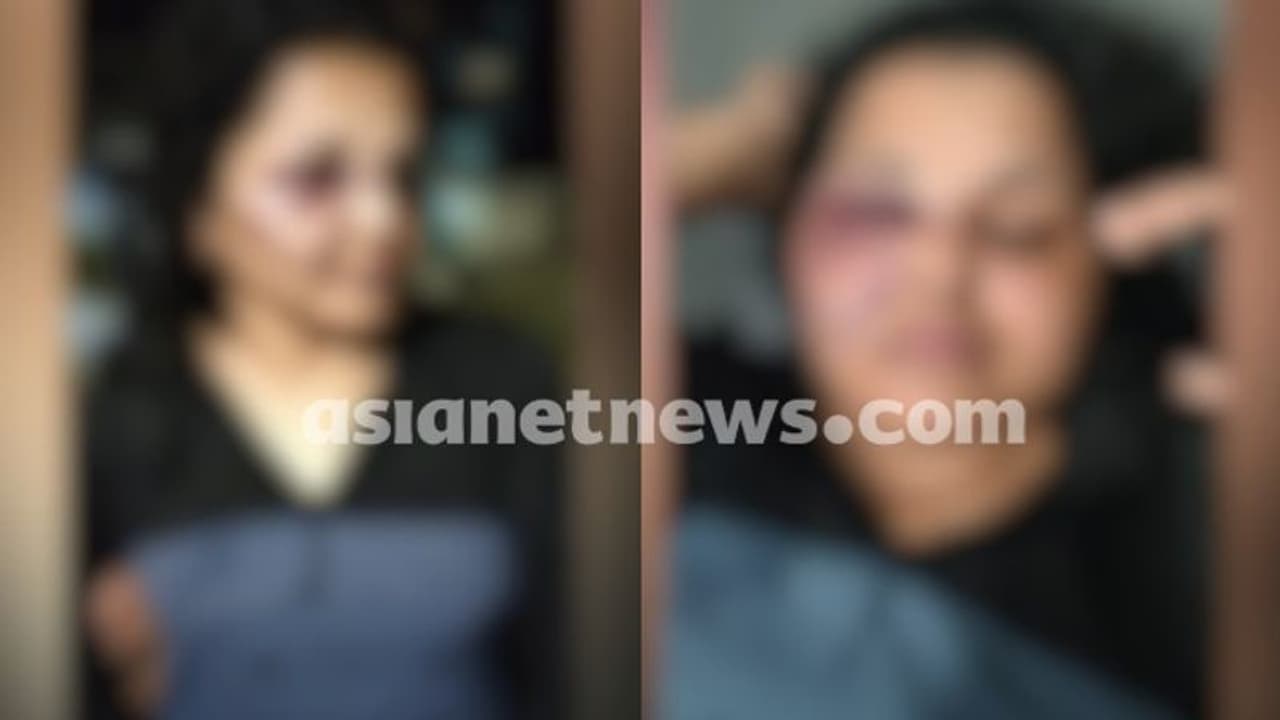 കോഴിക്കോട് സെയിൽ ഗേളിനെ വീട്ടിൽ പൂട്ടിയിട്ടു, ക്രൂരമായി മർദ്ദിച്ചു; കടയുടമ അറസ്റ്റില്, യുവതി ആശുപത്രിയിൽ കോഴിക്കോട് സെയിൽ ഗേളിനെ വീട്ടിൽ പൂട്ടിയിട്ടു, ക്രൂരമായി മർദ്ദിച്ചു; കടയുടമ അറസ്റ്റില്, യുവതി ആശുപത്രിയിൽ