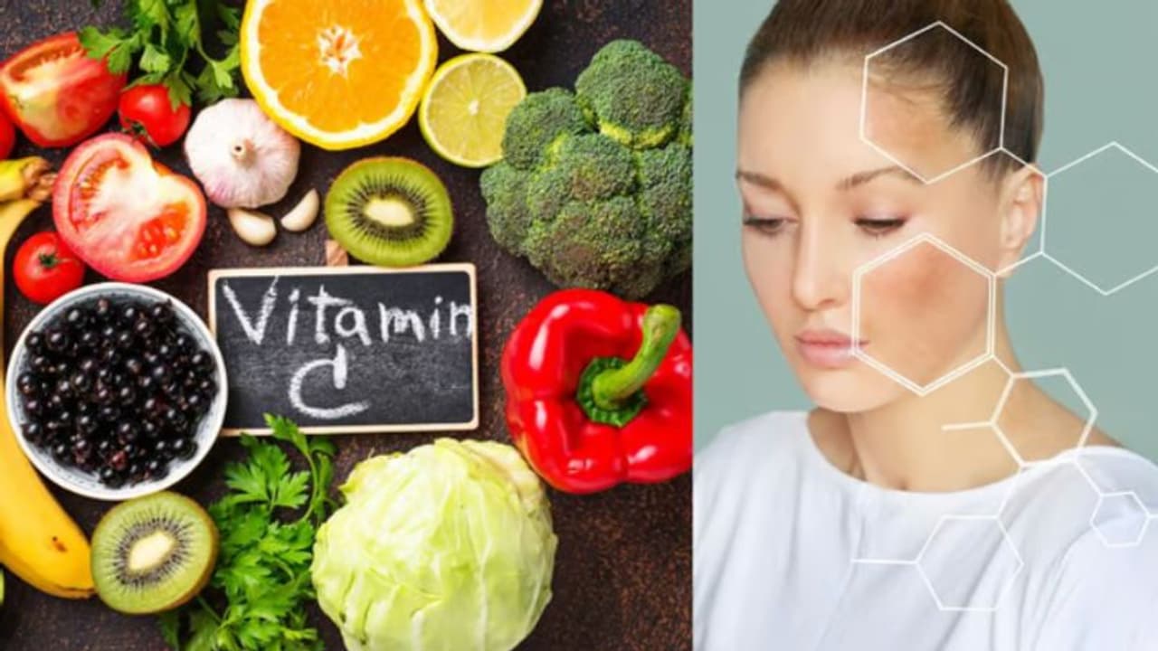 വിറ്റാമിൻ സിയുടെ കുറവുണ്ടോ? ശരീരം കാണിക്കും ഈ ലക്ഷണങ്ങള്... വിറ്റാമിൻ സിയുടെ കുറവുണ്ടോ? ശരീരം കാണിക്കും ഈ ലക്ഷണങ്ങള്...