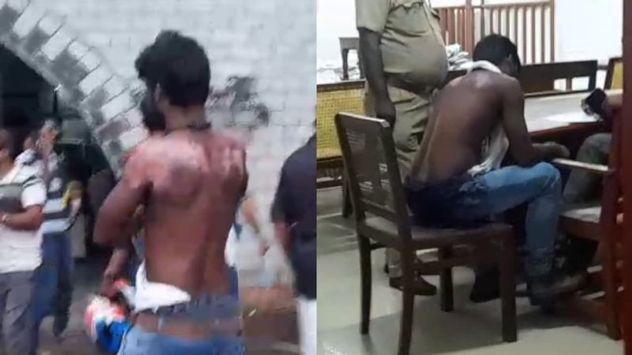 Kerala: Hot water allegedly poured on prisoner in Poojappura jail; Court seeks report within 10 days Kerala: Hot water allegedly poured on prisoner in Poojappura jail; Court seeks report within 10 days