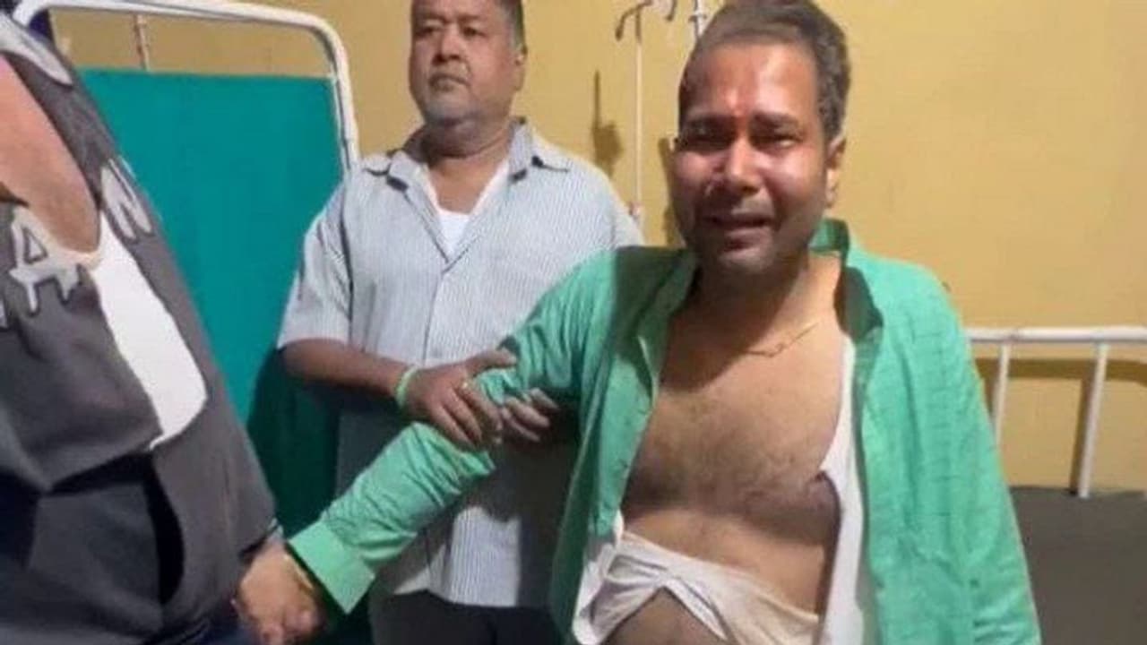 OMG! चुनाव में माहौल बनाने के लिए यहां के कैंडिडेट ने खुद की गाड़ी में लगा दी आग