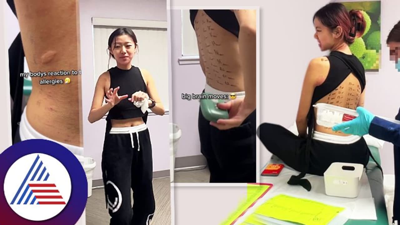 ಇವಳಿಗೆ ಏನೇ ತಿಂದ್ರೂ ಅಲರ್ಜಿ. ಸಾವಿನ ಕತ್ತಿ ಮೇಲೆ ಸಾಗಿಸ್ತಾಳೆ ಲೈಫು!