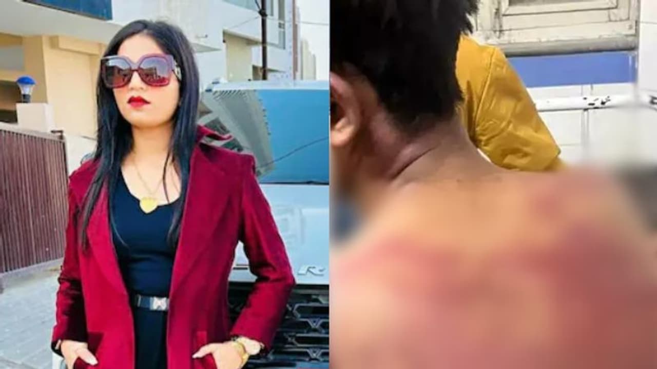 'ശമ്പളം ചോദിച്ചപ്പോൾ ചെരുപ്പ് വായിൽ തിരുകി, ബെൽറ്റ് കൊണ്ടടിച്ചു': 21കാരന്റെ പരാതി, ബിസിനസുകാരിക്കെതിരെ കേസ് 'ശമ്പളം ചോദിച്ചപ്പോൾ ചെരുപ്പ് വായിൽ തിരുകി, ബെൽറ്റ് കൊണ്ടടിച്ചു': 21കാരന്റെ പരാതി, ബിസിനസുകാരിക്കെതിരെ കേസ്