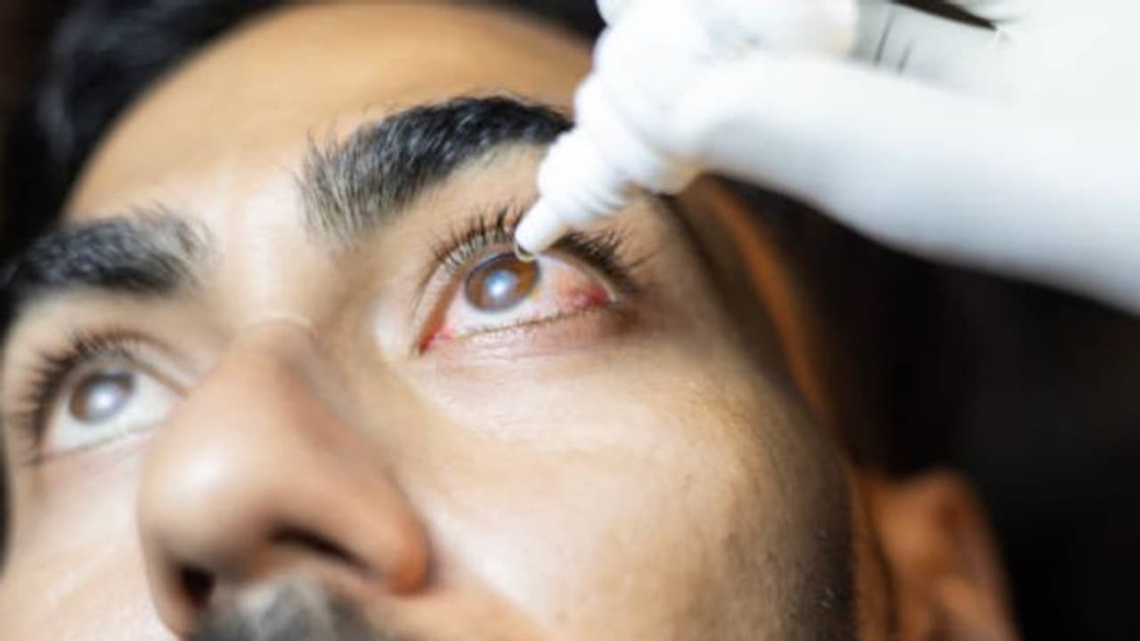 പുറത്തുപോയി വന്നാല് കണ്ണില് കലക്കവും നീറ്റലും ചൊറിച്ചിലും അനുഭവപ്പെടാറുണ്ടോ? പുറത്തുപോയി വന്നാല് കണ്ണില് കലക്കവും നീറ്റലും ചൊറിച്ചിലും അനുഭവപ്പെടാറുണ്ടോ?