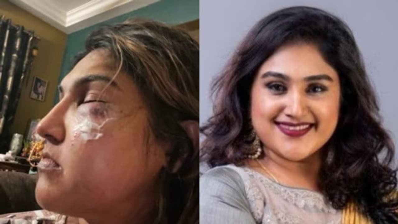 'ആക്രമണത്തില്‍ പരുക്കേറ്റു', ബിഗ് ബോസ് താരത്തിനെതിരെ നടി വനിതാ വിജയകുമാര്‍