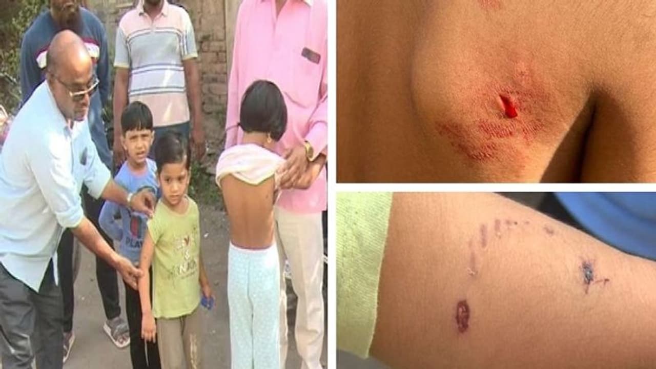 Karnataka: Vijayapura residents demand urgent action as stray dogs attack students
