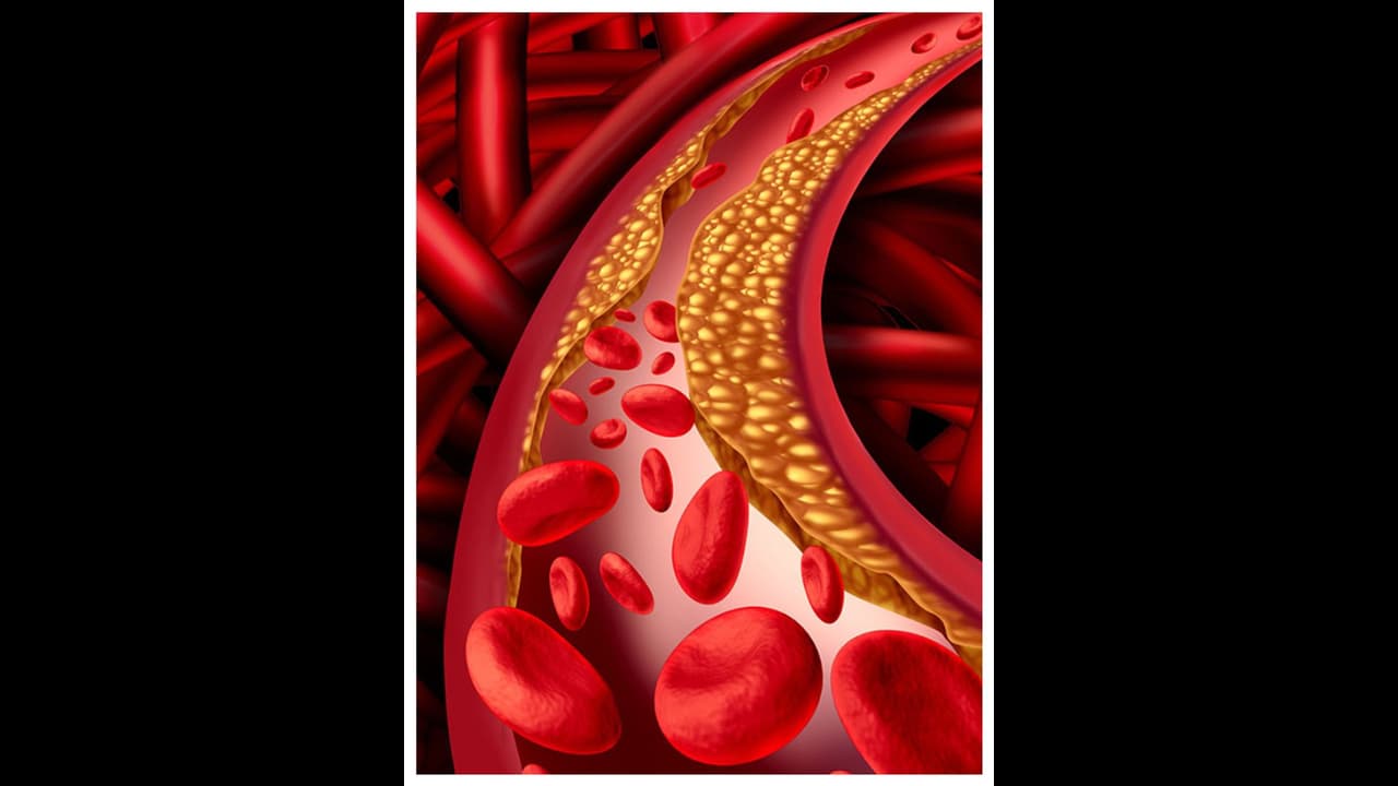 കൊളസ്ട്രോൾ നിയന്ത്രിക്കാൻ കഴിക്കാം ഈ സൂപ്പർ ഫുഡുകൾ 