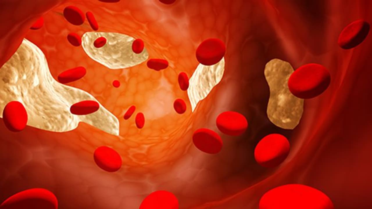 കൊളസ്ട്രോൾ നിയന്ത്രിക്കുന്നതിന് ചെയ്യേണ്ടത് എന്തൊക്കെ? കൊളസ്ട്രോൾ നിയന്ത്രിക്കുന്നതിന് ചെയ്യേണ്ടത് എന്തൊക്കെ?