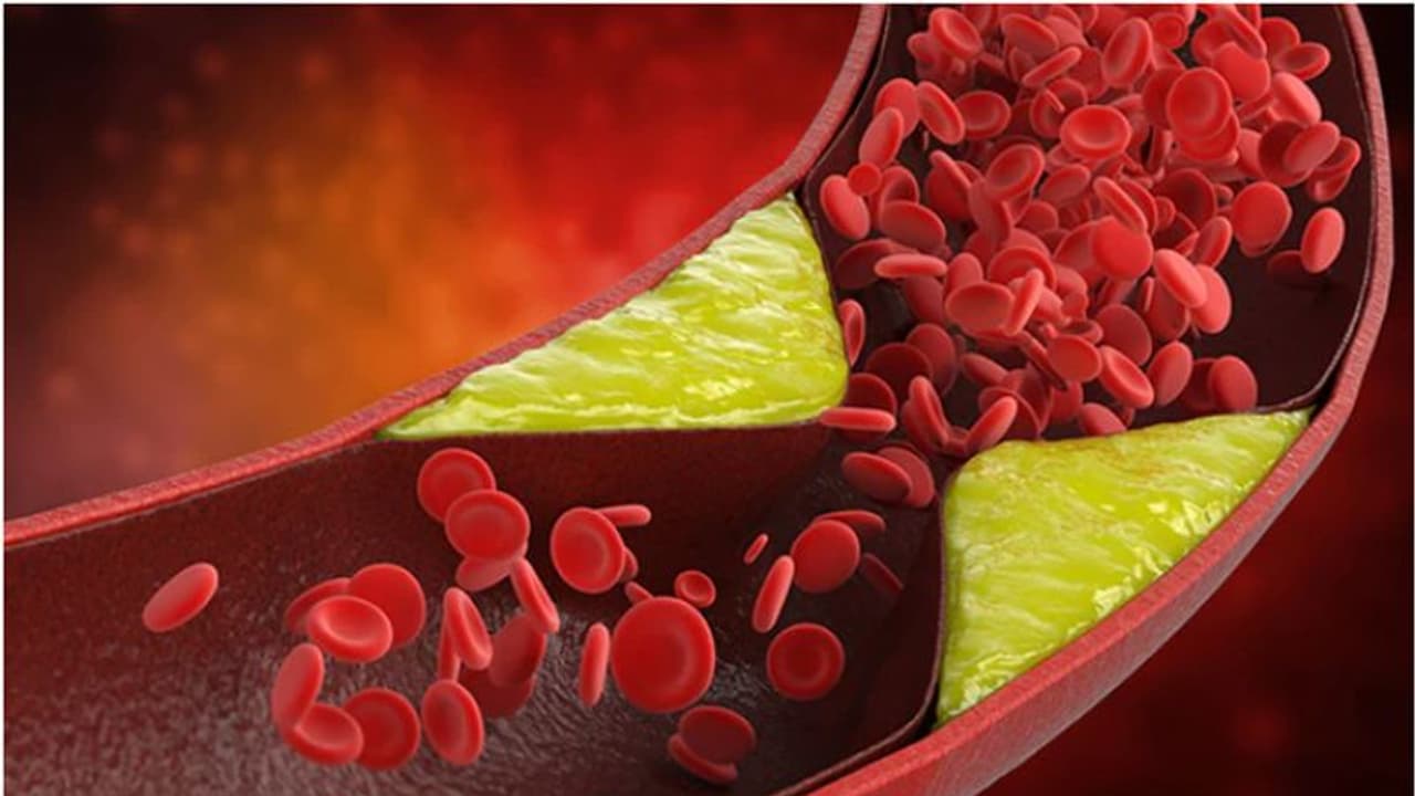 ഈ ആറ് ഭക്ഷണങ്ങള് മാത്രം മതി, ചീത്ത കൊളസ്ട്രോളിനെ കുറയ്ക്കാം... ഈ ആറ് ഭക്ഷണങ്ങള് മാത്രം മതി, ചീത്ത കൊളസ്ട്രോളിനെ കുറയ്ക്കാം...