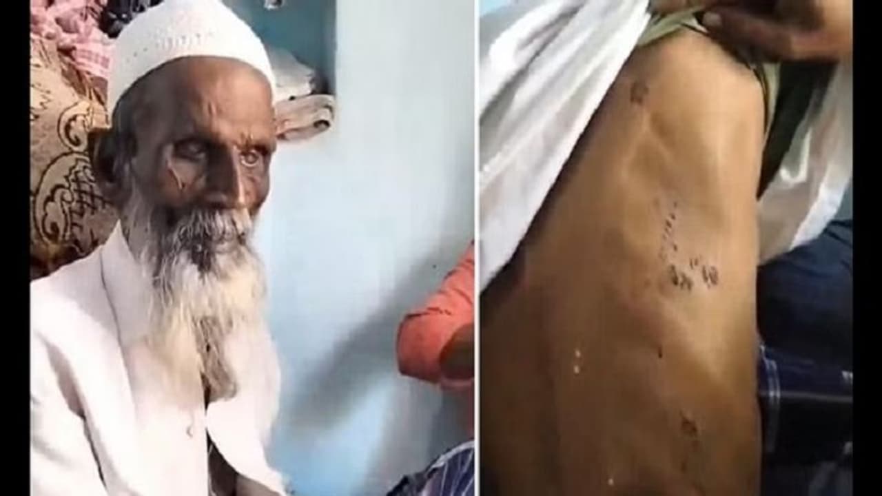 ಜೈ ಶ್ರೀರಾಮ್ ಹೇಳುವಂತೆ ಅಂಧ ಮುಸ್ಲಿಂ ವೃದ್ಧನ ಮೇಲೆ ಹಲ್ಲೆ, ಗಡ್ಡಕ್ಕೆ ಬೆಂಕಿ; ಕರ್ನಾಟಕದಲ್ಲೂ ಆರಂಭವಾಯ್ತು ಹೀನ ಕೃತ್ಯ! ಜೈ ಶ್ರೀರಾಮ್ ಹೇಳುವಂತೆ ಅಂಧ ಮುಸ್ಲಿಂ ವೃದ್ಧನ ಮೇಲೆ ಹಲ್ಲೆ, ಗಡ್ಡಕ್ಕೆ ಬೆಂಕಿ; ಕರ್ನಾಟಕದಲ್ಲೂ ಆರಂಭವಾಯ್ತು ಹೀನ ಕೃತ್ಯ!