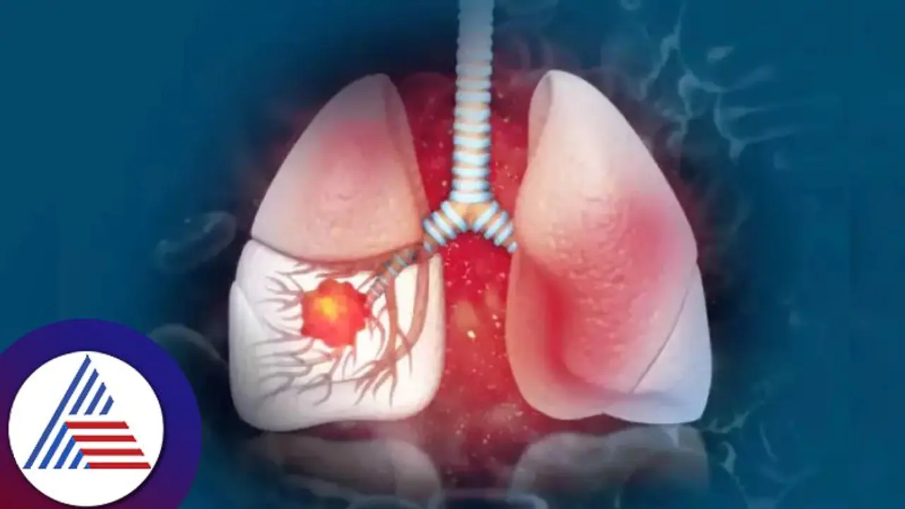ಮಕ್ಕಳನ್ನು ಕಾಡ್ತಿದೆ ಅಪಾಯಕಾರಿ ಶ್ವಾಸಕೋಶ ರೋಗ, ಏನಿದು ವೈಟ್ ಲಂಗ್ ಸಿಂಡ್ರೋಮ್?