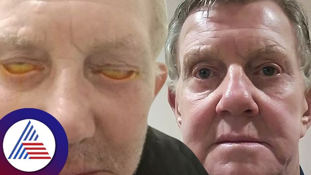 ನಾಲ್ಕು ವರ್ಷವಾಯ್ತು, ಈ ವ್ಯಕ್ತಿ ಕಣ್ಣಿನ ರೆಪ್ಪೆಯನ್ನೇ ಮುಚ್ಚಿಲ್ಲ! ಮತ್ತೆ ಹೇಗೆ ನಿದ್ರಿಸುತ್ತಾರೆ!