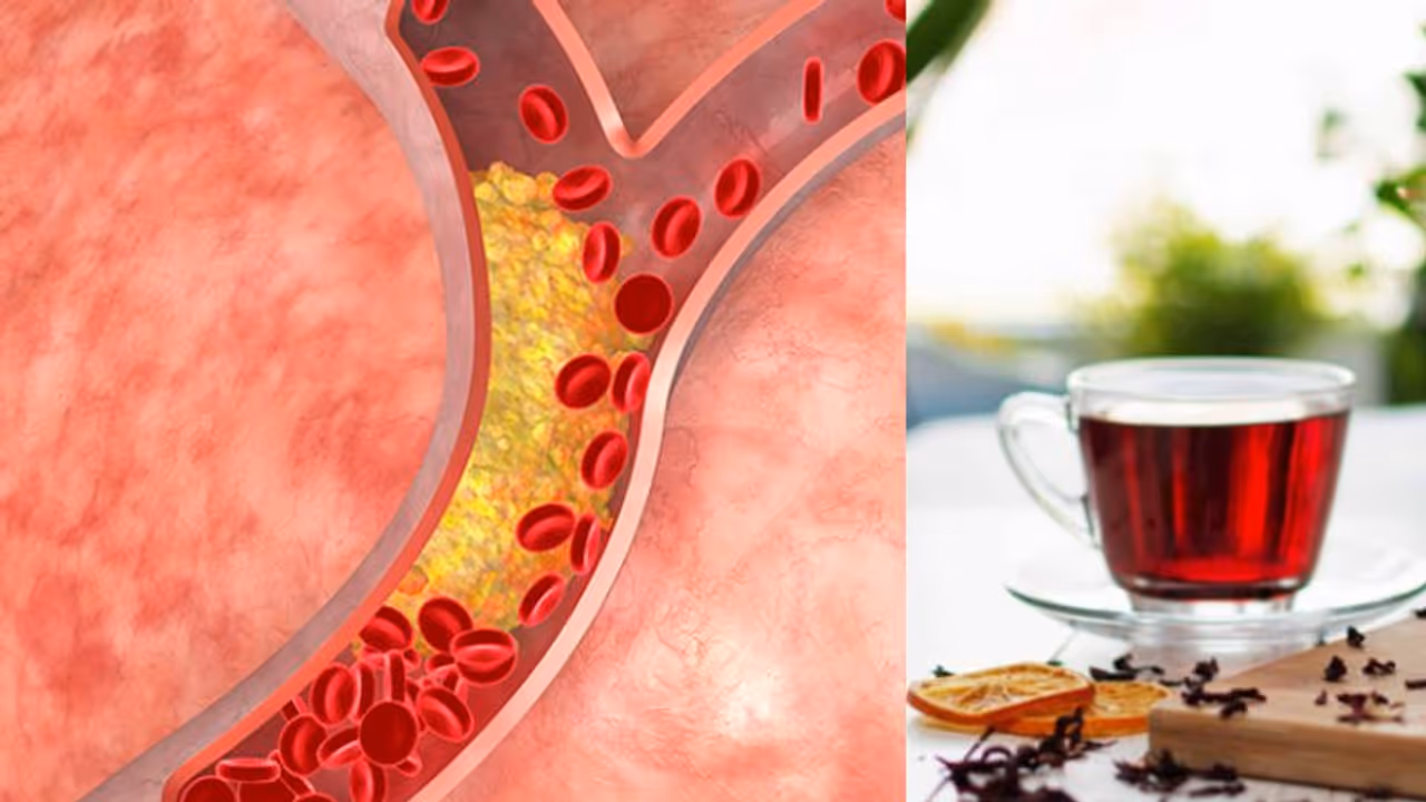 ചീത്ത കൊളസ്ട്രോളിനെ കുറയ്ക്കാന് രാവിലെ കുടിക്കാം ഈ പാനീയം; അറിയാം മറ്റ് ഗുണങ്ങള്... ചീത്ത കൊളസ്ട്രോളിനെ കുറയ്ക്കാന് രാവിലെ കുടിക്കാം ഈ പാനീയം; അറിയാം മറ്റ് ഗുണങ്ങള്...