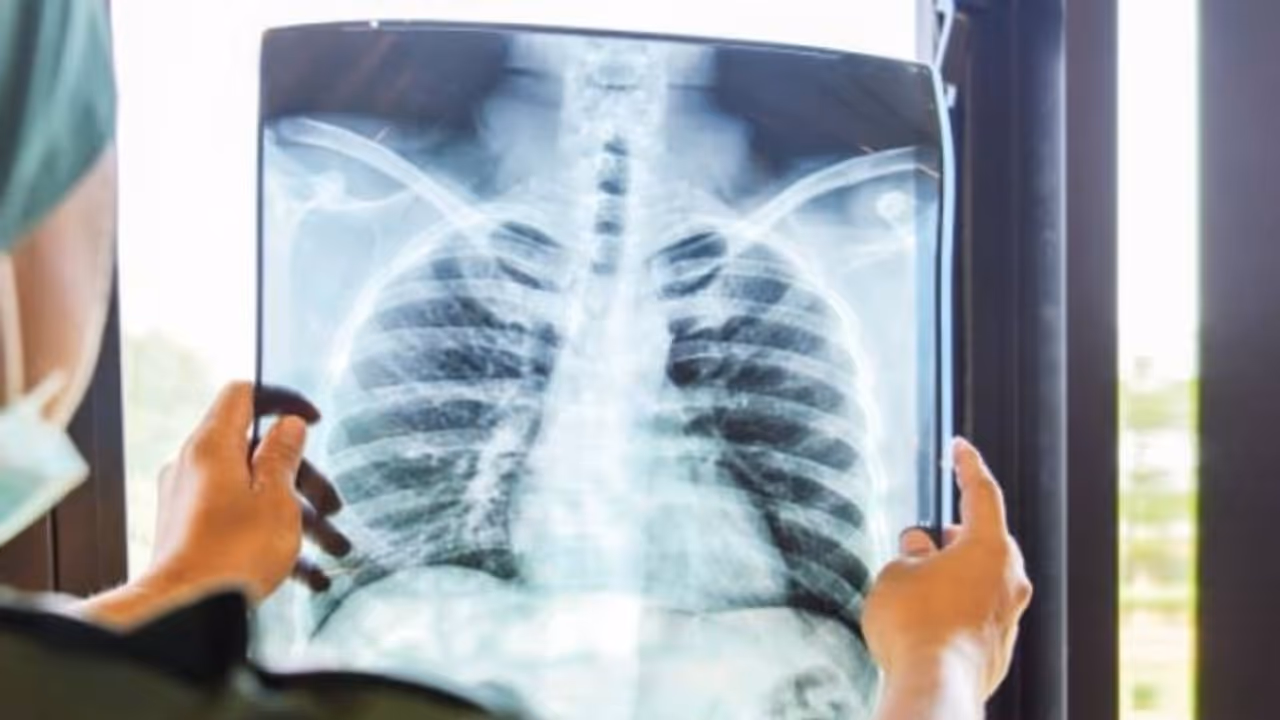 World Pneumonia Day 2024 : ന്യുമോണിയ ഹൃദയാഘാത സാധ്യത കൂട്ടുമോ? വിദ​ഗ്ധർ പറയുന്നു