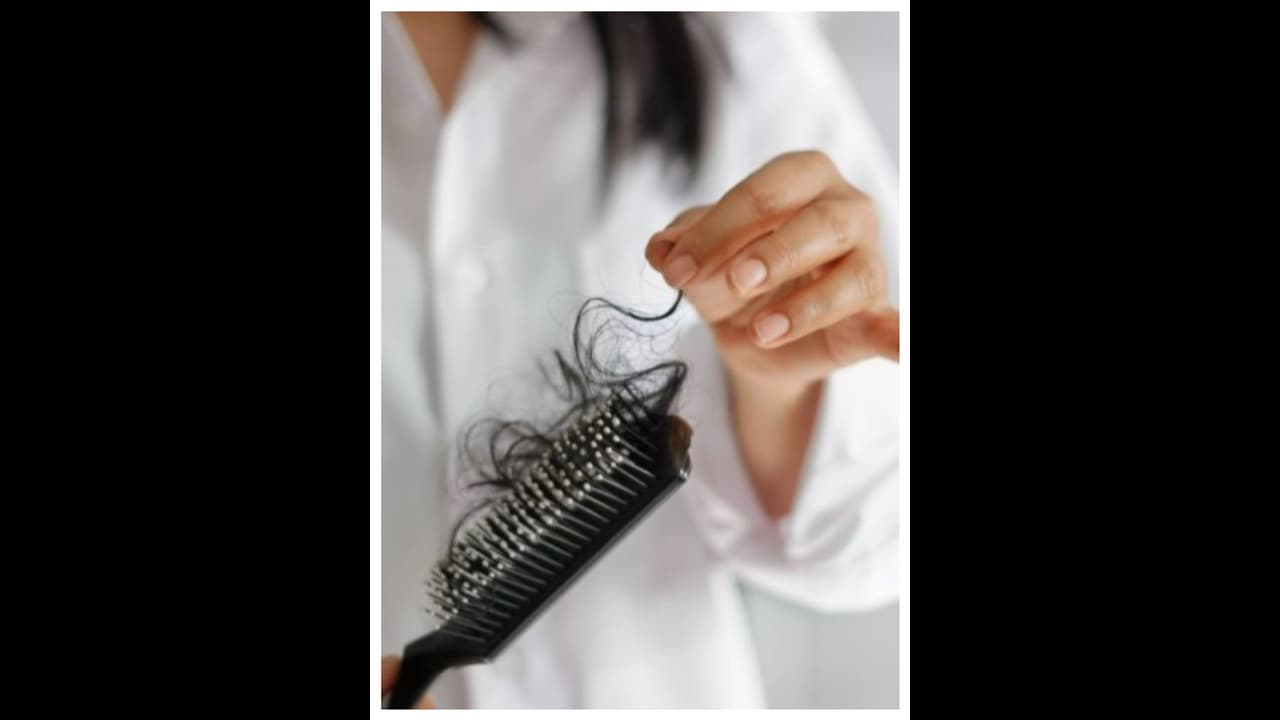 തണുപ്പുകാലത്തെ മുടികൊഴിച്ചിൽ ; കാരണങ്ങൾ ഇതാകാം തണുപ്പുകാലത്തെ മുടികൊഴിച്ചിൽ ; കാരണങ്ങൾ ഇതാകാം