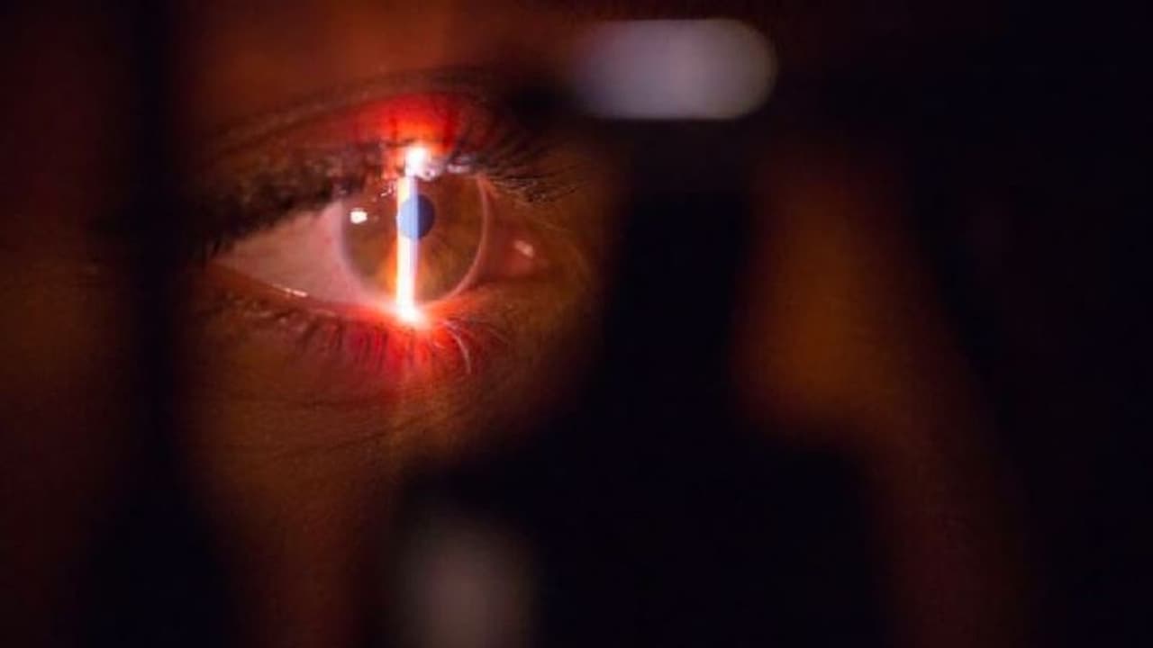 ಅಬ್ಬಬ್ಬಾ..ಮಹಿಳೆ ಕಣ್ಣಿನಿಂದ ಬರೋಬ್ಬರಿ 60 ಜೀವಂತ ಹುಳು ಹೊರ ತೆಗೆದ ವೈದ್ಯರು!