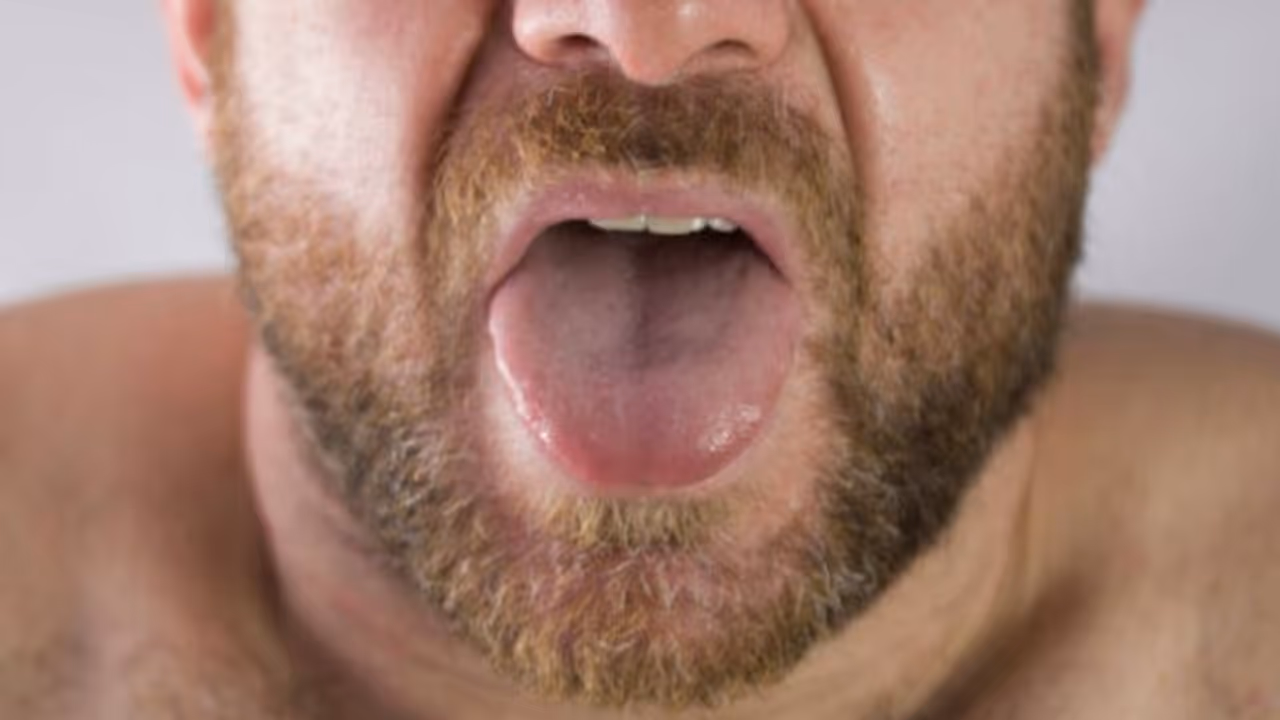 നാവിലെ നിറം മാറ്റത്തിലൂടെ അസുഖങ്ങളും ആരോഗ്യപ്രശ്നങ്ങളും മനസിലാക്കാം... നാവിലെ നിറം മാറ്റത്തിലൂടെ അസുഖങ്ങളും ആരോഗ്യപ്രശ്നങ്ങളും മനസിലാക്കാം...