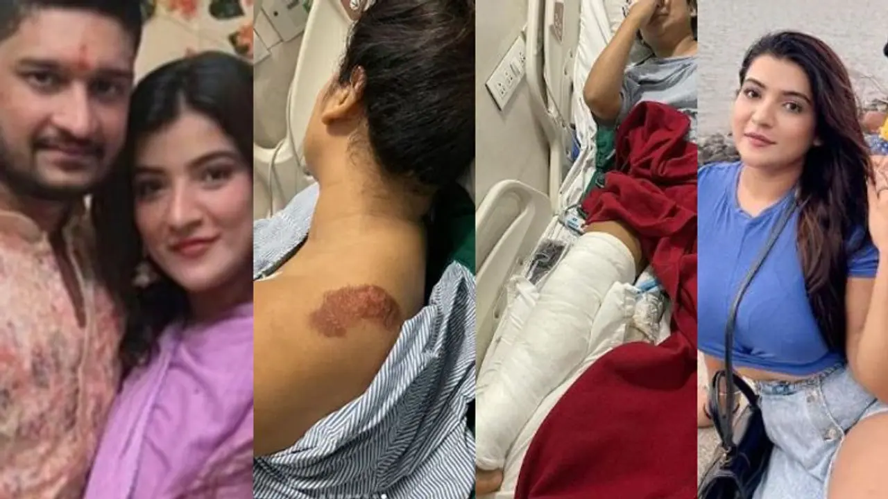 'ശ്വാസം മുട്ടിച്ചു, തലമുടി വലിച്ച് നിലത്തിട്ടു, കാലിൽ കാർ കയറ്റി'; കാമുകൻ ഇൻസ്റ്റ താരത്തോട് ചെയ്തത് ക്രൂരത!