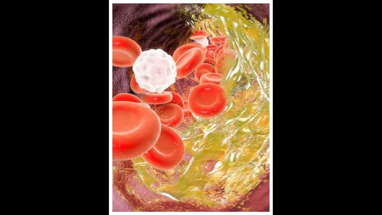 മരുന്നുകളില്ലാതെ കൊളസ്ട്രോൾ കുറയ്ക്കാം ; ഈ മൂന്ന് ഭക്ഷണങ്ങൾ ഡയറ്റിൽ ഉൾപ്പെടുത്തൂ മരുന്നുകളില്ലാതെ കൊളസ്ട്രോൾ കുറയ്ക്കാം ; ഈ മൂന്ന് ഭക്ഷണങ്ങൾ ഡയറ്റിൽ ഉൾപ്പെടുത്തൂ