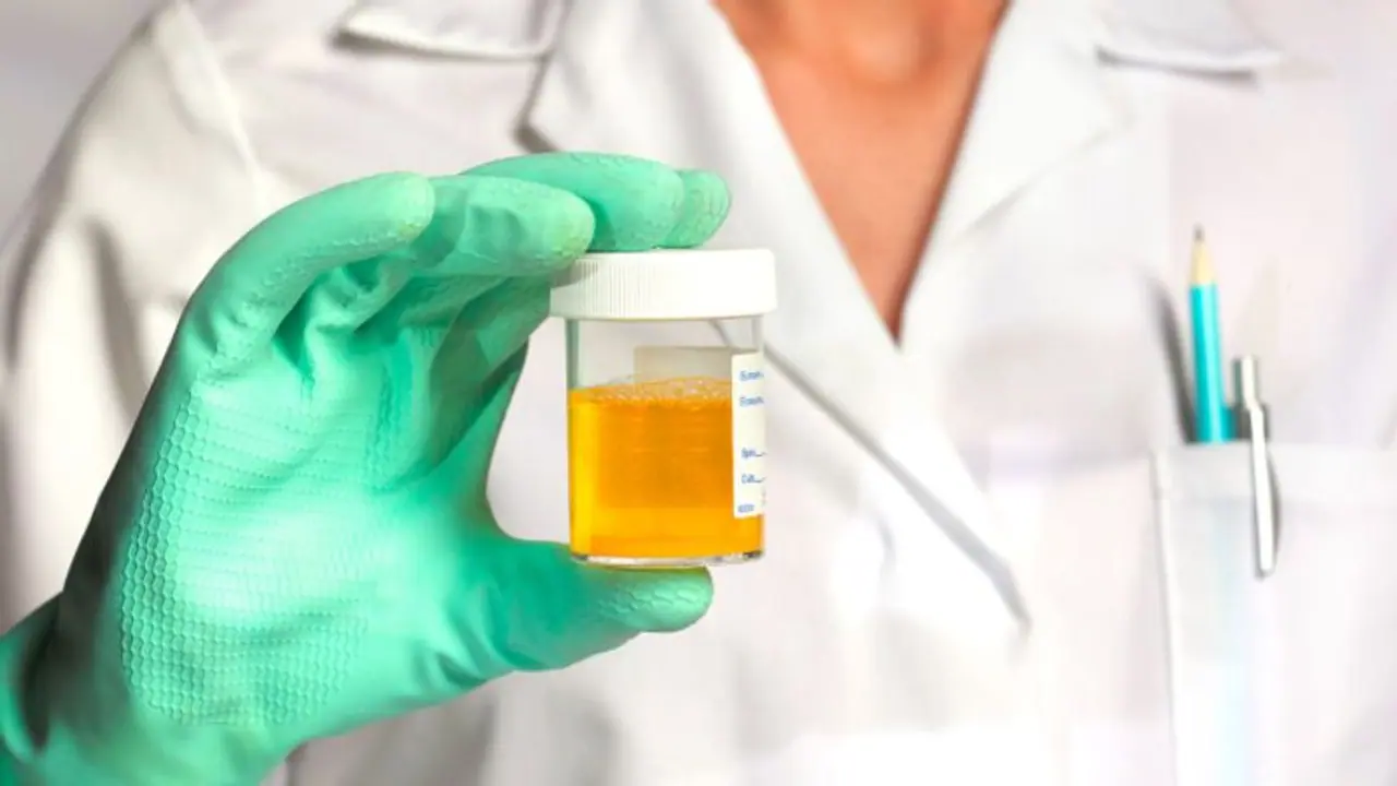 മൂത്രത്തിന് കടും മഞ്ഞ നിറമാണോ? എന്നാൽ ഇതൊന്ന് അറിഞ്ഞിരിക്കാം... മൂത്രത്തിന് കടും മഞ്ഞ നിറമാണോ? എന്നാൽ ഇതൊന്ന് അറിഞ്ഞിരിക്കാം...