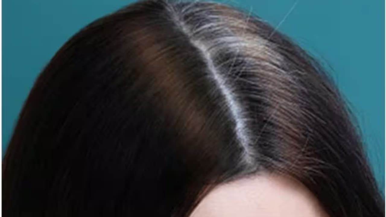 അകാലനര അലട്ടുന്നുണ്ടോ? അറിയാം കാരണങ്ങളും ചില പൊടിക്കൈകളും... അകാലനര അലട്ടുന്നുണ്ടോ? അറിയാം കാരണങ്ങളും ചില പൊടിക്കൈകളും...