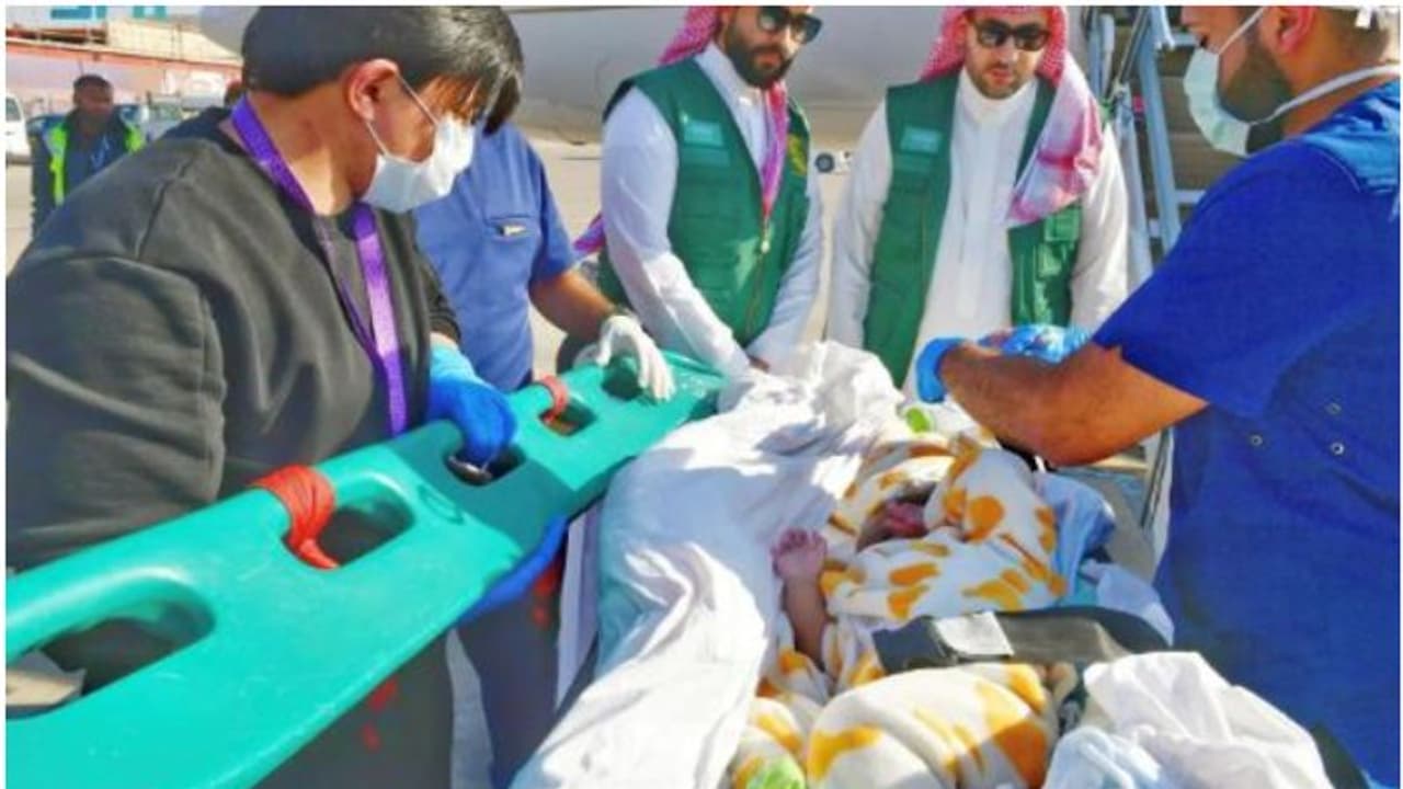 വേർപെടുത്തൽ ശസ്ത്രക്രിയക്കായി എറിത്രിയൻ സയാമീസ് ഇരട്ടകളെ റിയാദിലെത്തിച്ചു വേർപെടുത്തൽ ശസ്ത്രക്രിയക്കായി എറിത്രിയൻ സയാമീസ് ഇരട്ടകളെ റിയാദിലെത്തിച്ചു