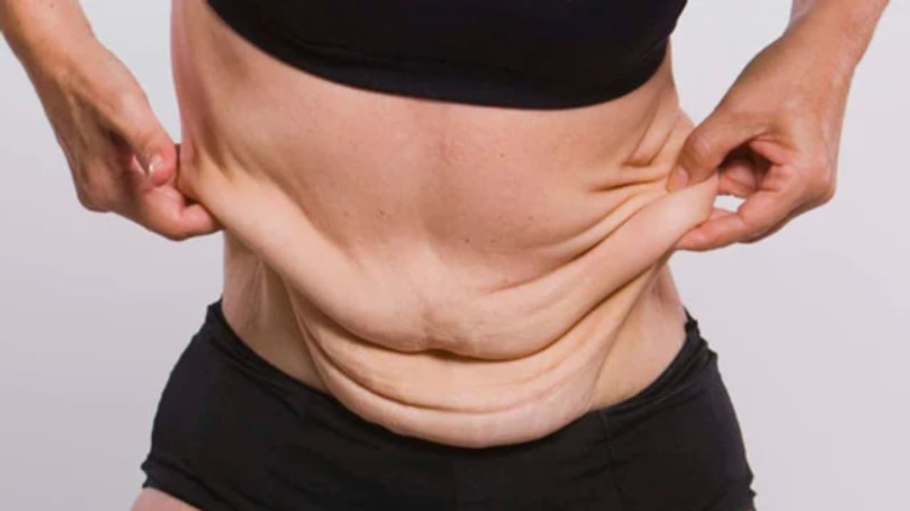 വണ്ണം കുറച്ചതിന് ശേഷമുള്ള അയഞ്ഞു തൂങ്ങിയ ചർമ്മം ഒഴിവാക്കാന്‍ ചെയ്യേണ്ട ഒമ്പത് കാര്യങ്ങള്‍... 