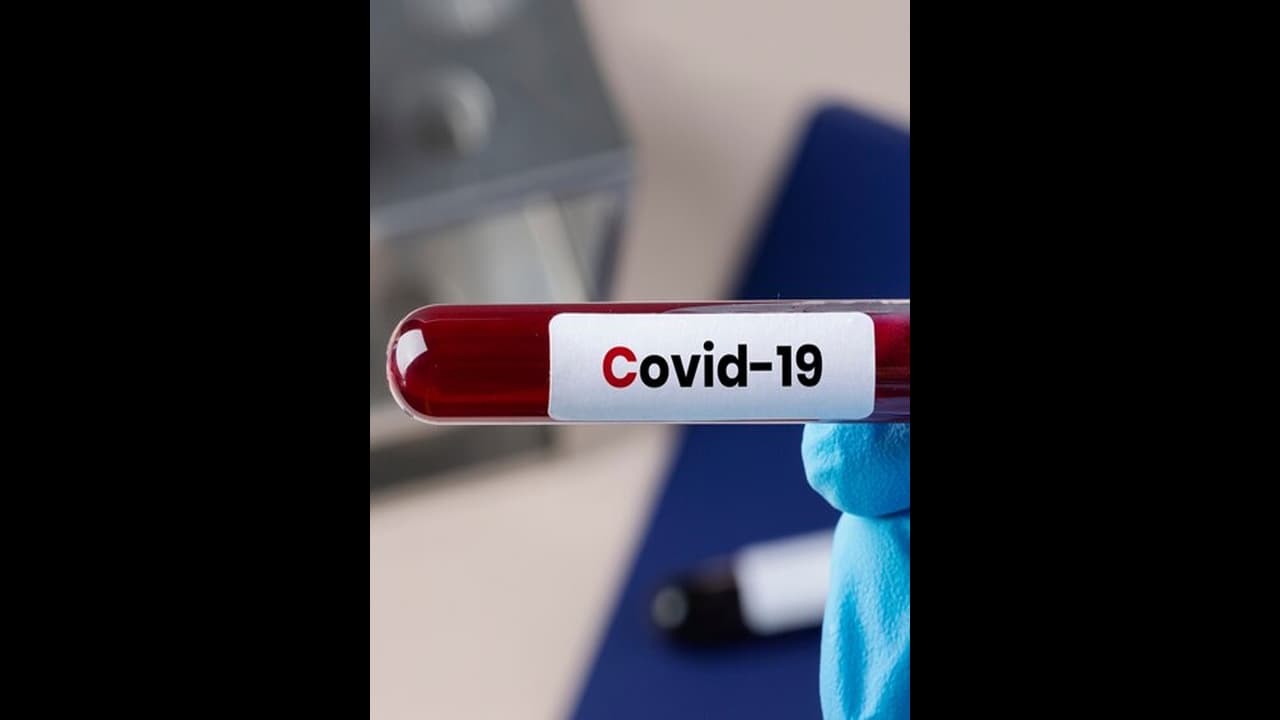 ಮೈಸೂರಿನಲ್ಲಿ 7 ಕೊರೋನಾ ಪ್ರಕರಣ, ಆತಂಕ ಪಡುವ ಅಗತ್ಯ ಇಲ್ಲ: ಡಿಸಿ ಮೈಸೂರಿನಲ್ಲಿ 7 ಕೊರೋನಾ ಪ್ರಕರಣ, ಆತಂಕ ಪಡುವ ಅಗತ್ಯ ಇಲ್ಲ: ಡಿಸಿ