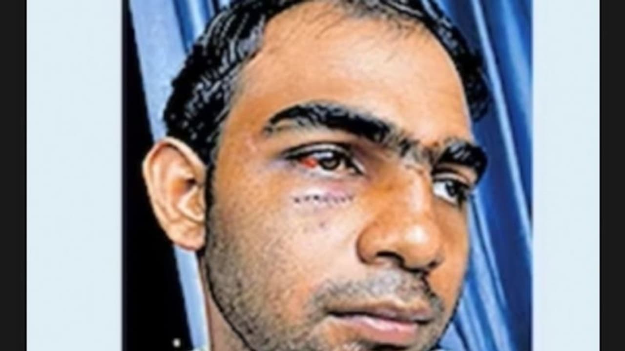 യുവാവിനെ കാറില്‍ തട്ടി കൊണ്ടുപോയി ക്രൂരമര്‍ദ്ദനം: മൂന്നു പേര്‍ പിടിയില്‍ 