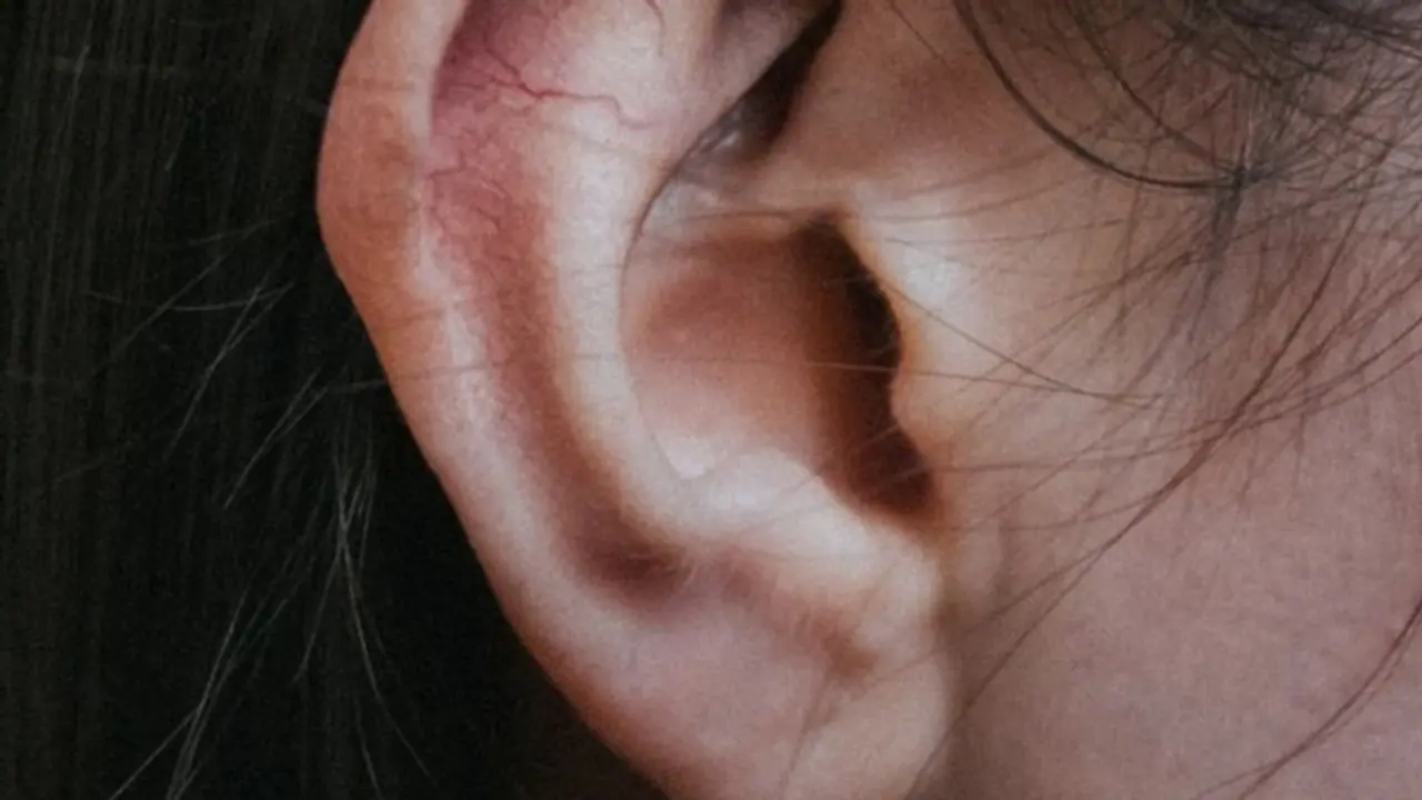 യുവതിയുടെ ചെവിക്കകത്ത് വല നെയ്ത് കൂടി എട്ടുകാലി; ആശുപത്രിയിലെത്തിയത് ചെവി വേദനയുമായി യുവതിയുടെ ചെവിക്കകത്ത് വല നെയ്ത് കൂടി എട്ടുകാലി; ആശുപത്രിയിലെത്തിയത് ചെവി വേദനയുമായി